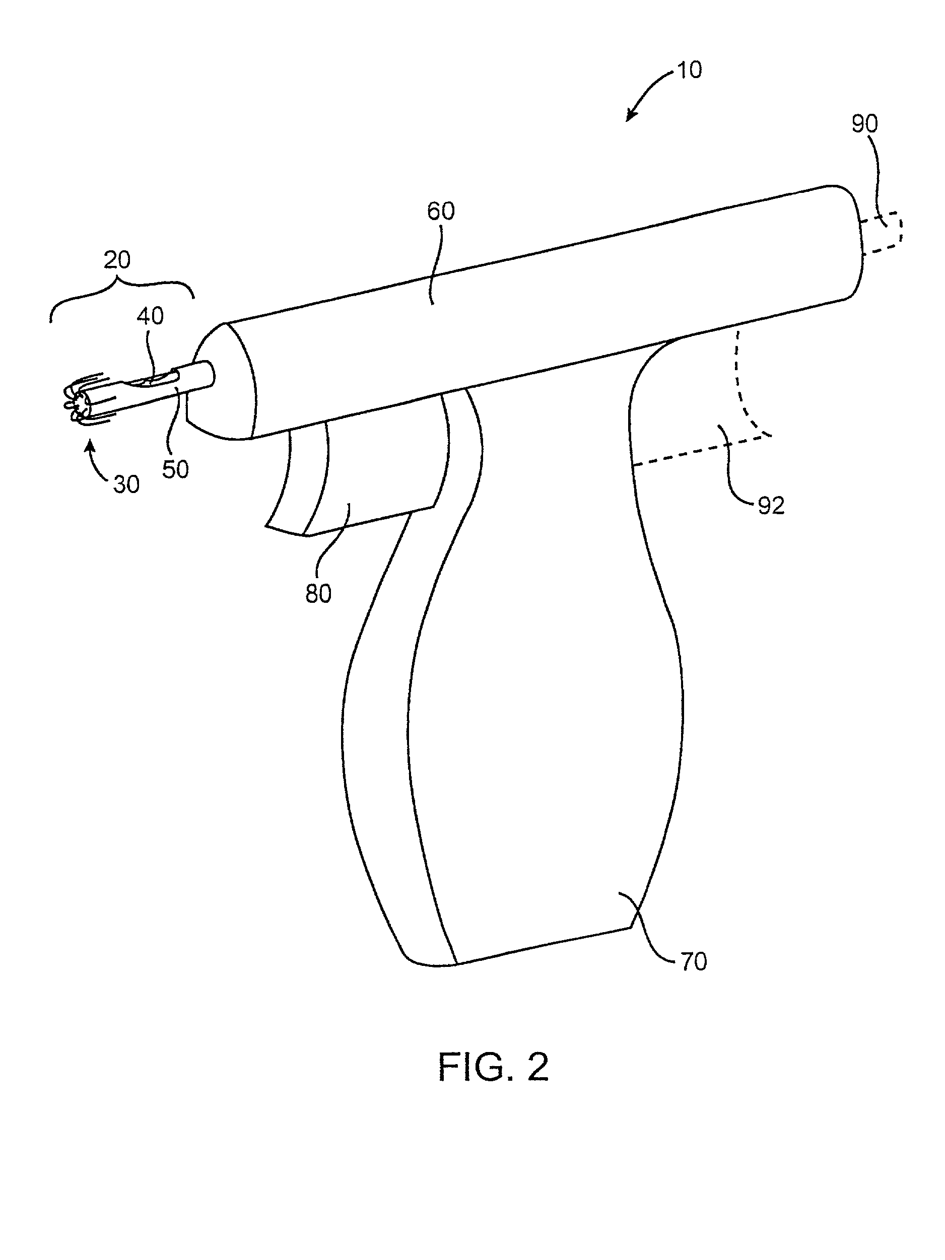 Device and method for performing end-to-side anastomosis