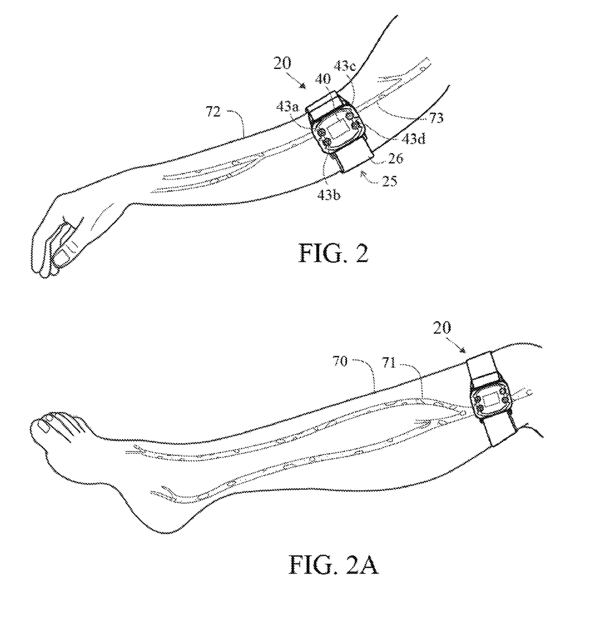 Mobile plethysmographic device