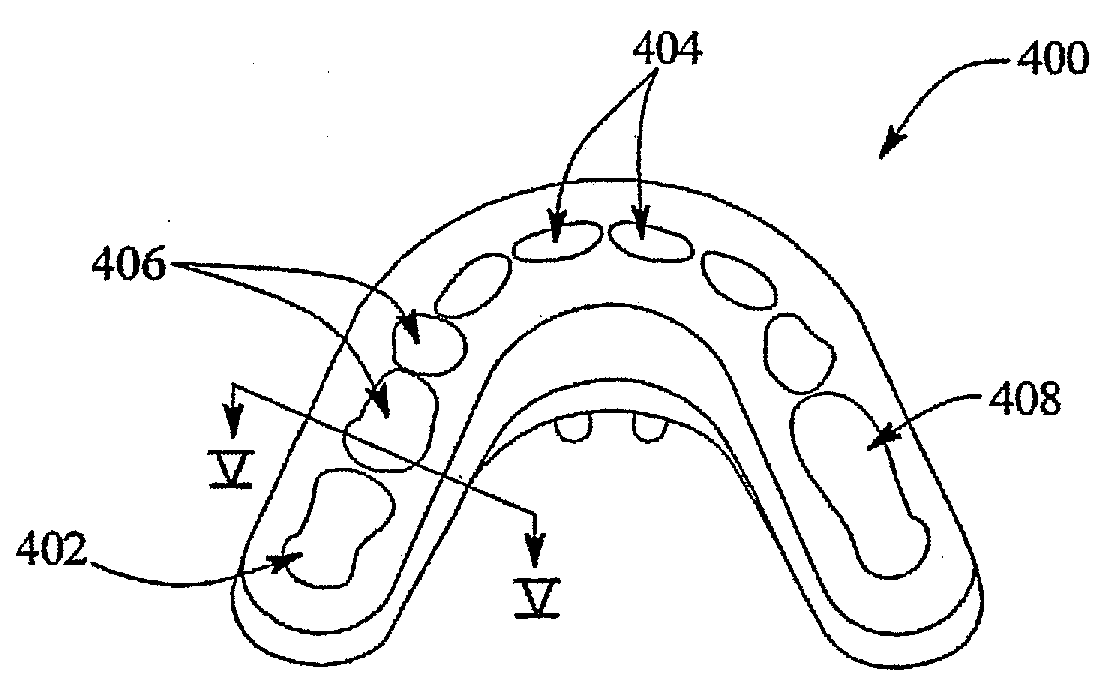 Orthodontic appliance, a system and a method for automatically straightening teeth