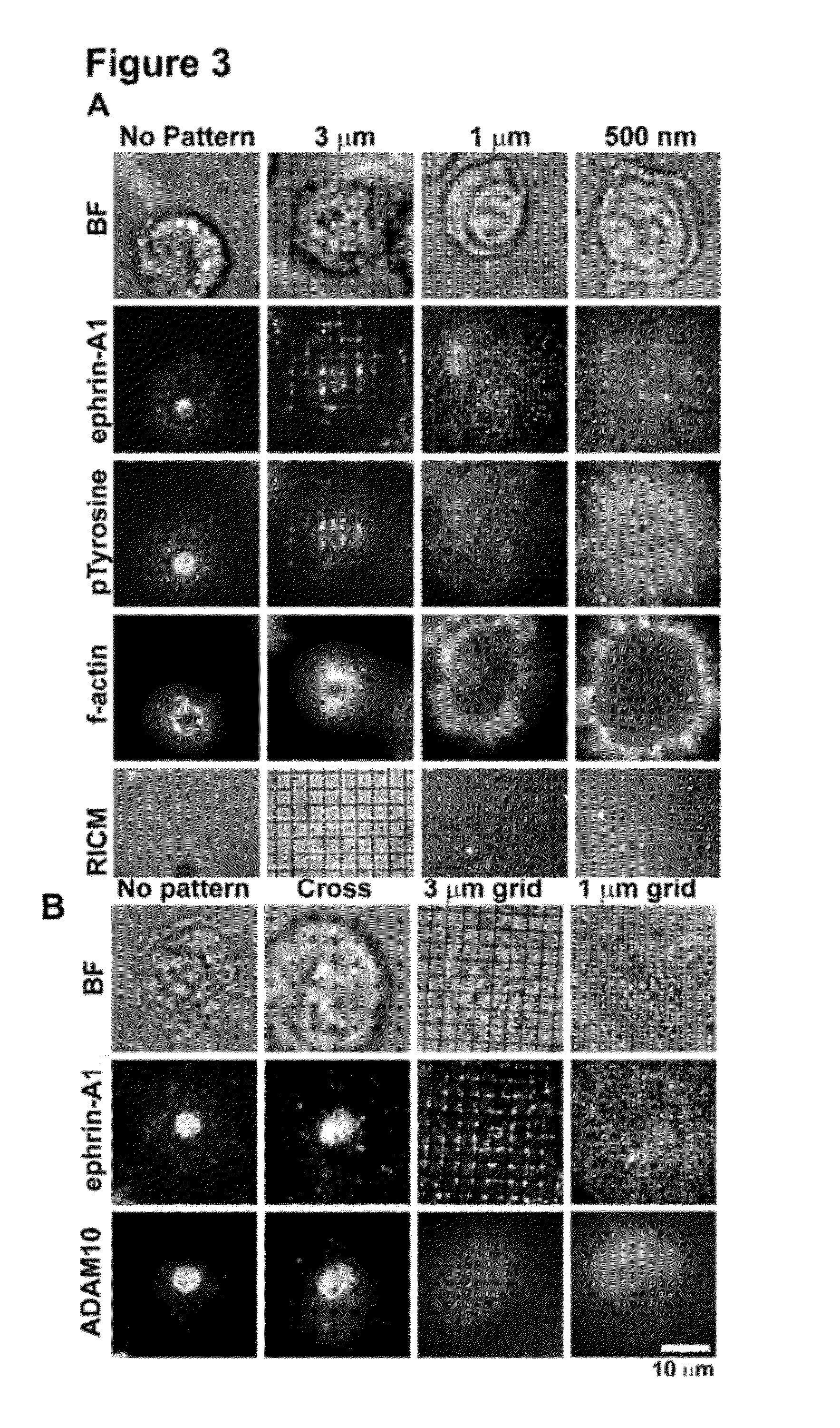 Spatial Biomarker of Disease and Detection of Spatial Organization of Cellular Receptors