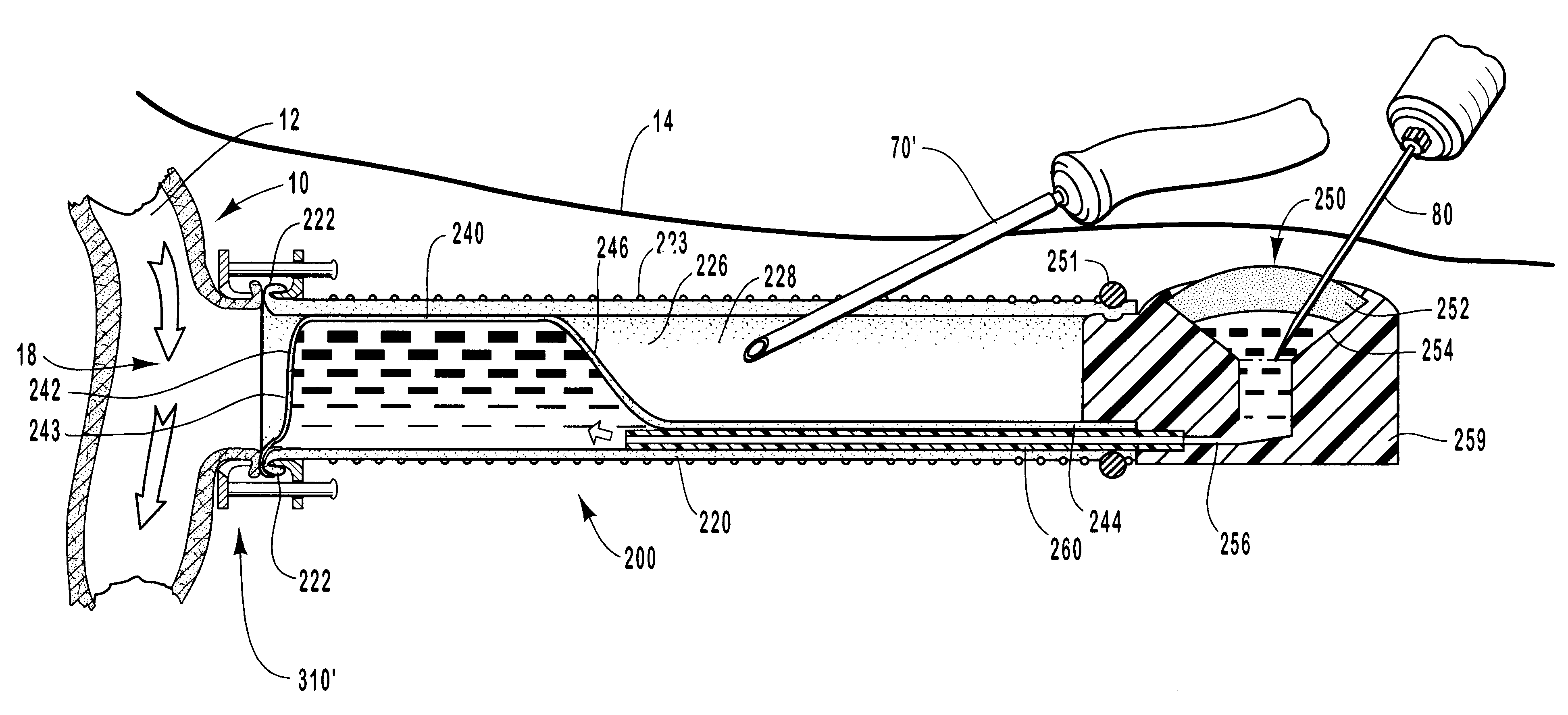 Vascular occlusal balloons and related vascular access devices and systems