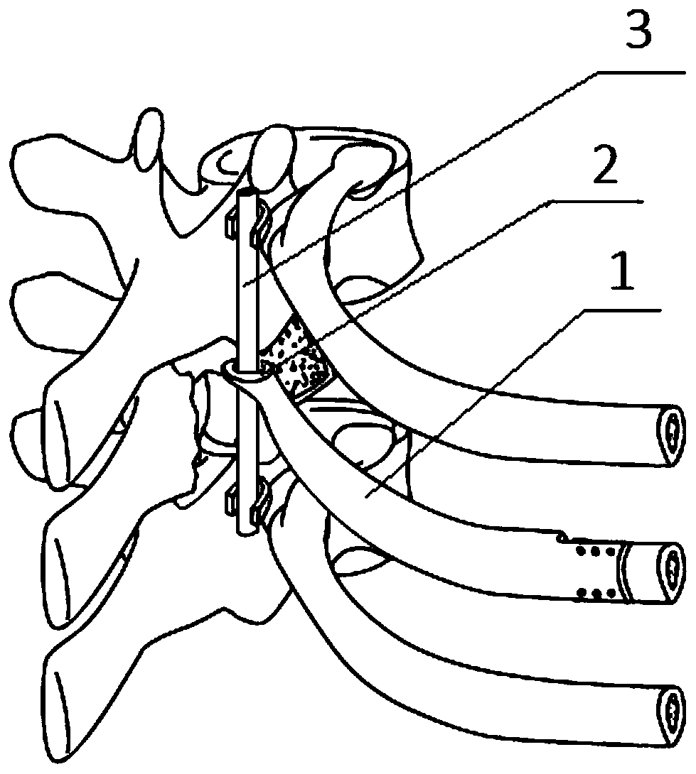 Costovertebral joint and reconstruction method thereof