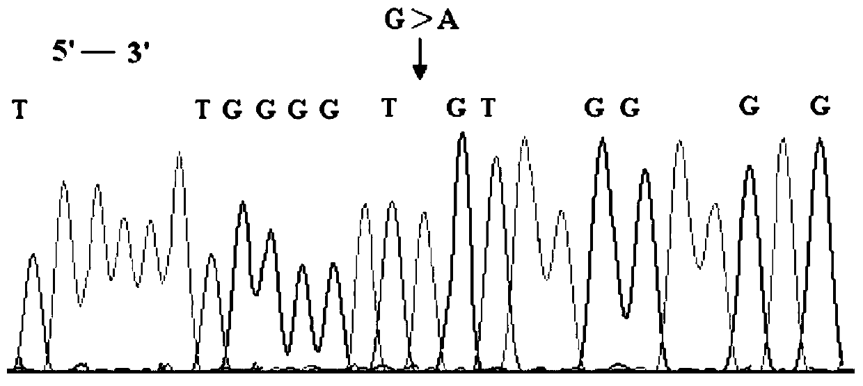 PIK3CA gene g.1792224821G&gt;A mutation and application thereof to auxiliary diagnosis of breast cancer