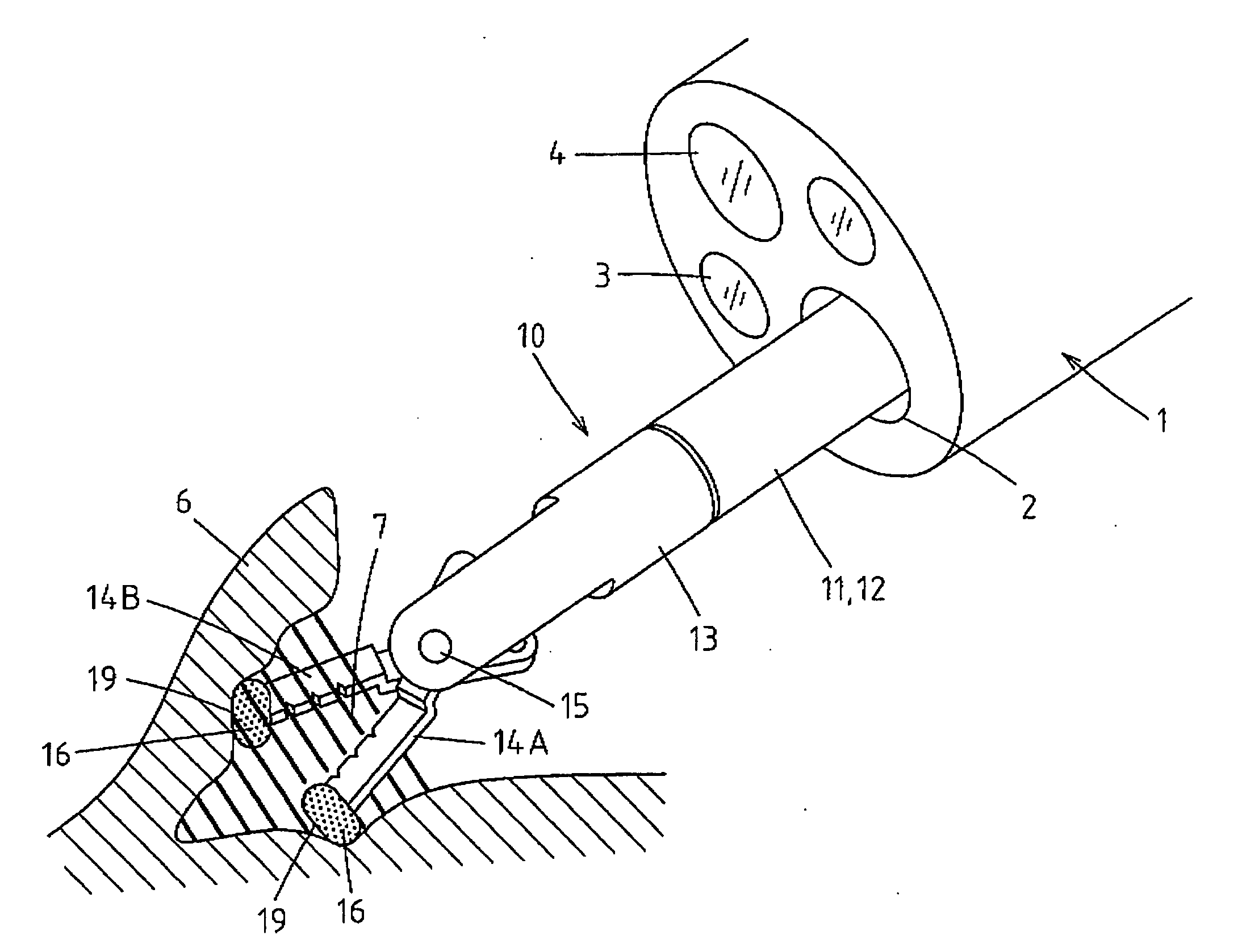 High frequency incision tool for endoscope