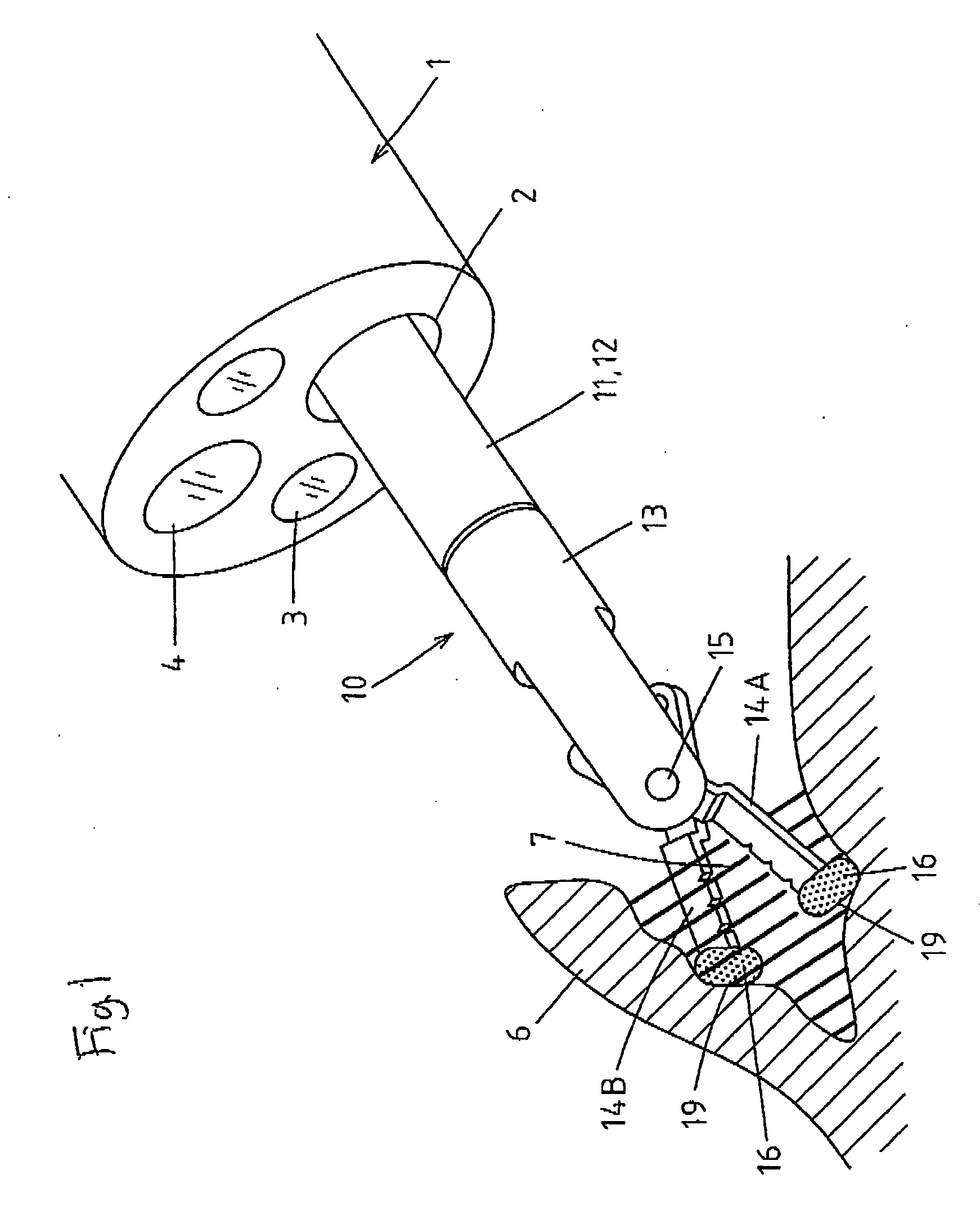 High frequency incision tool for endoscope