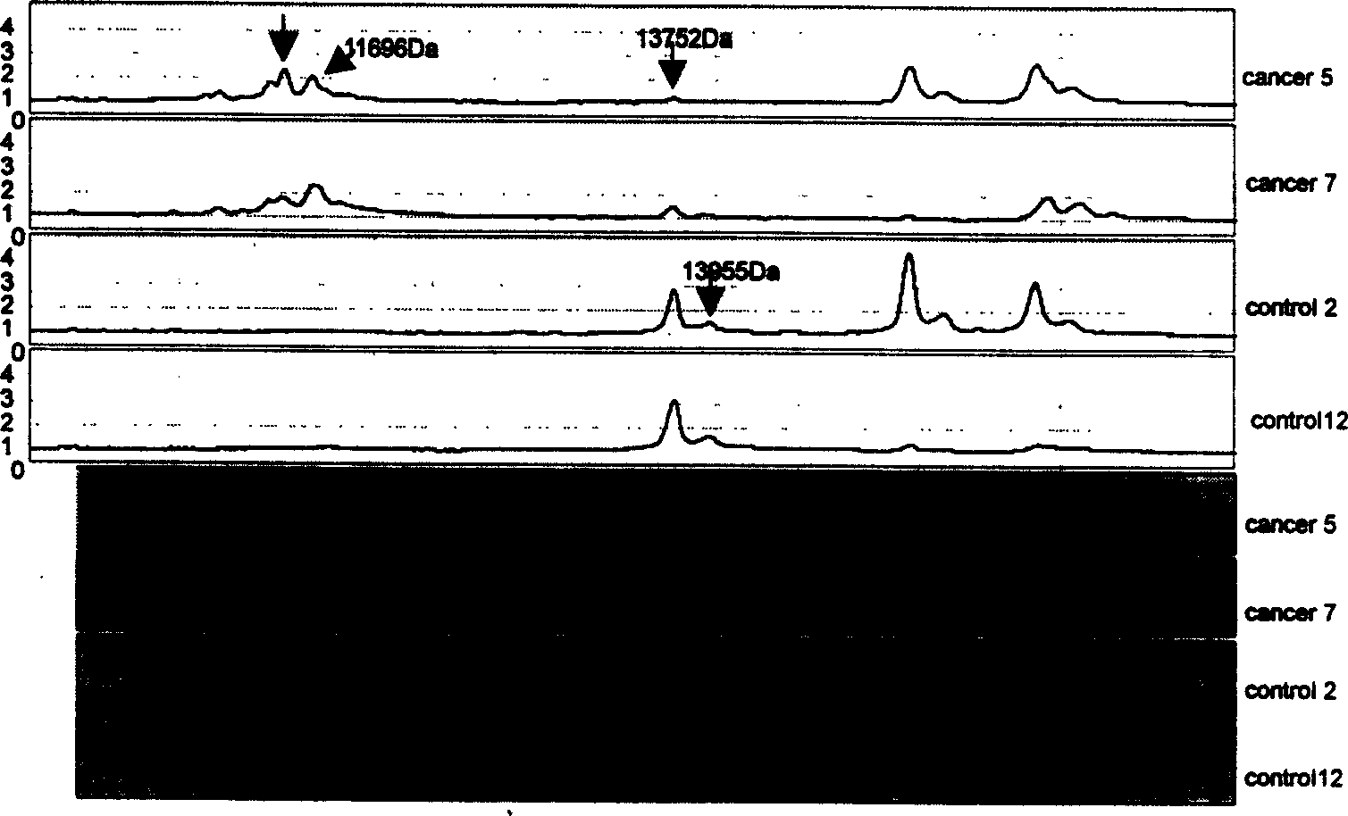 Mass spectrum model for detecting liver cancer serum characteristic protein and method for preparation