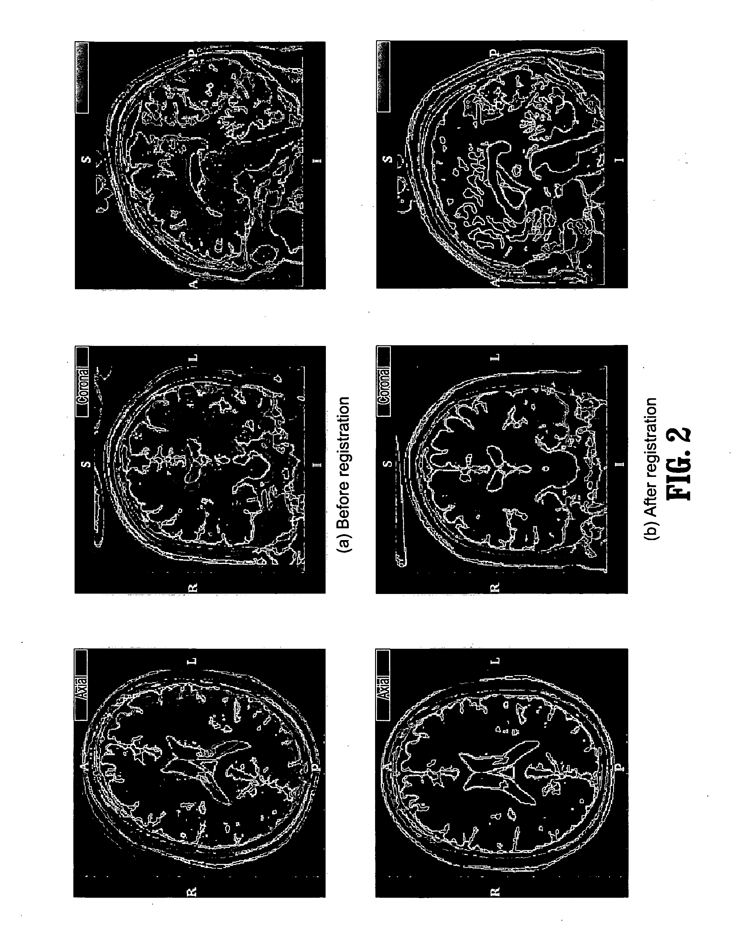 System and method for fast multimodal registration by least squares