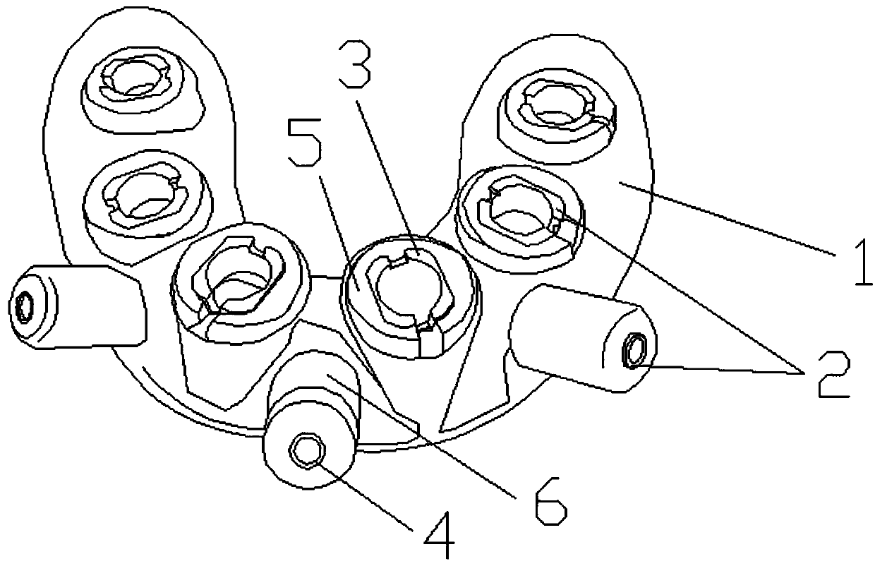 Method for designing and preparing guide plate for dental implant surgery