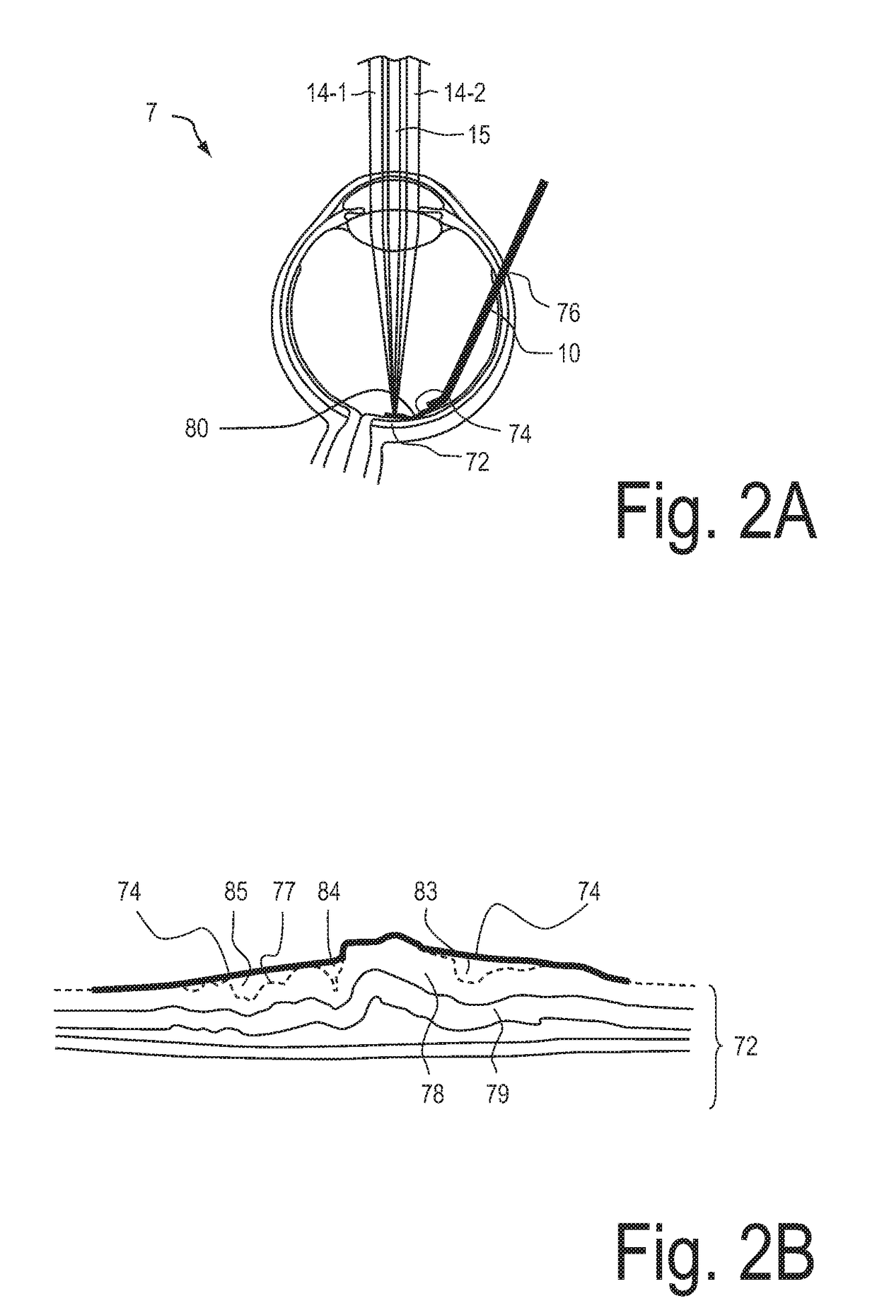 System for eye examination by means of stress-dependent parameters