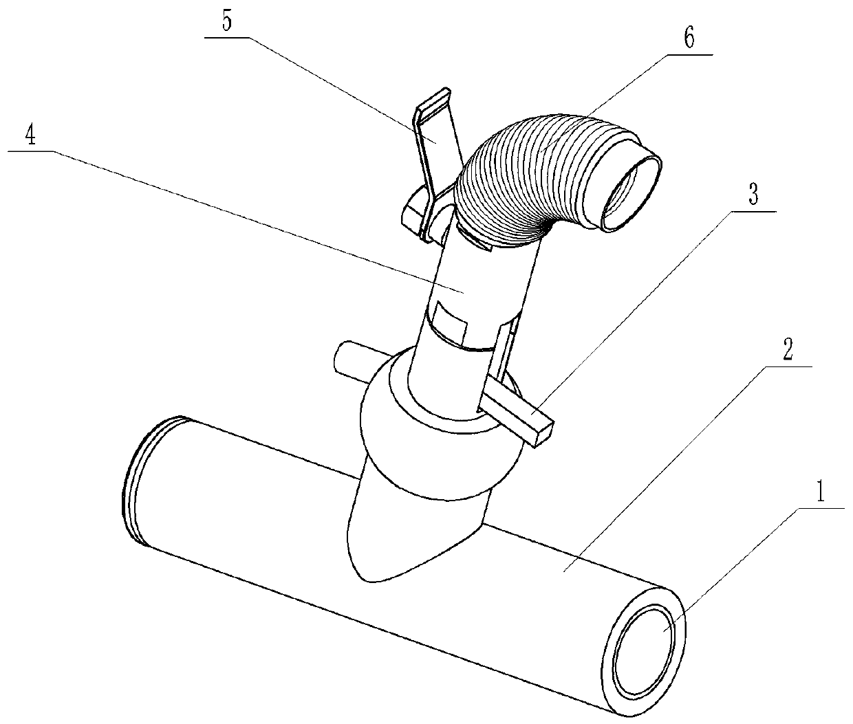 Fistulation-free enterostomy device