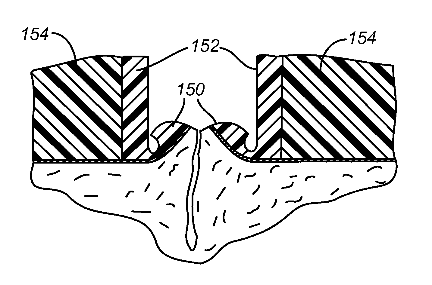 Biopsy incision closure device