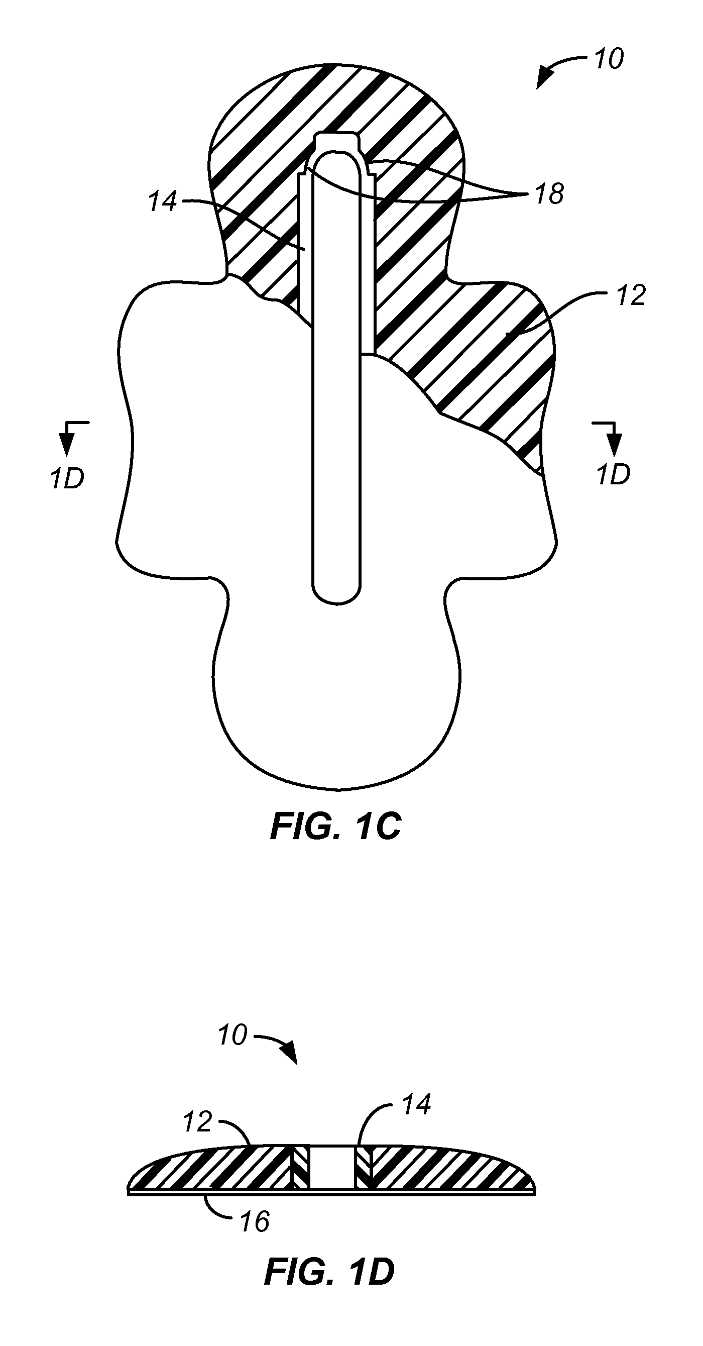 Biopsy incision closure device