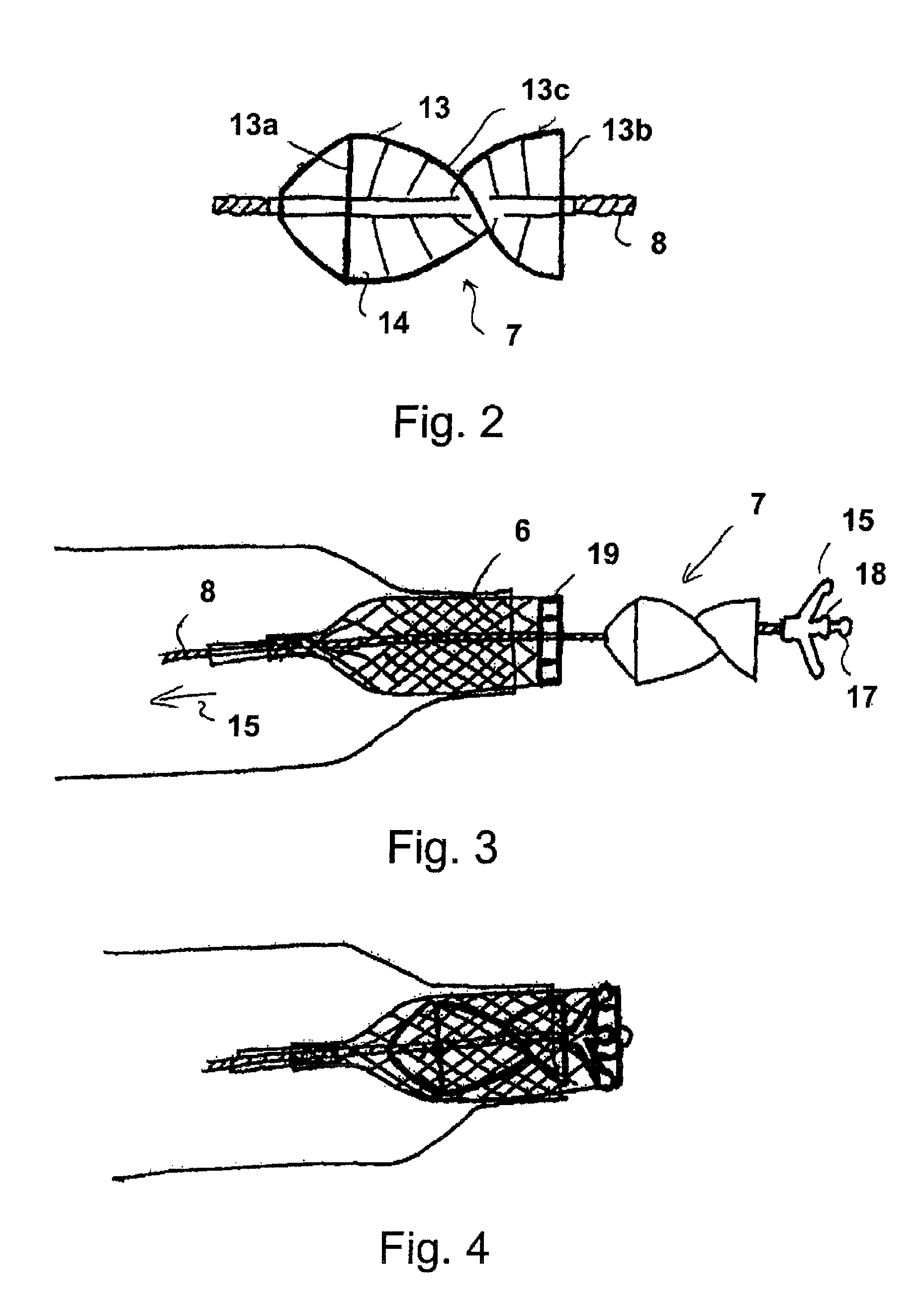 Fluid pump changeable in diameter, in particular for medical application