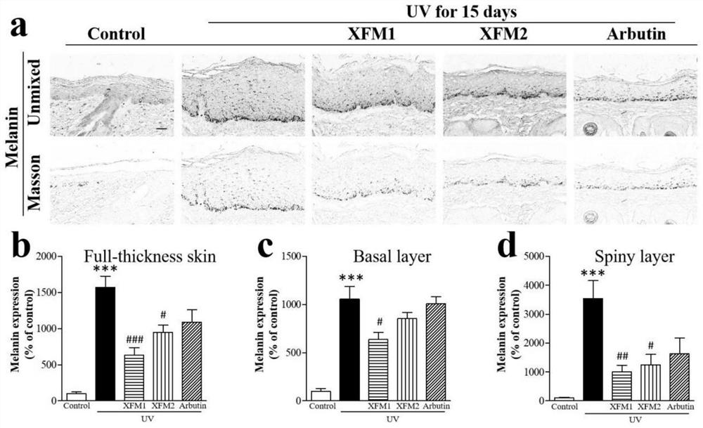 A kind of whitening and freckle-removing essence for external use to treat skin pigmentation and its preparation method and application