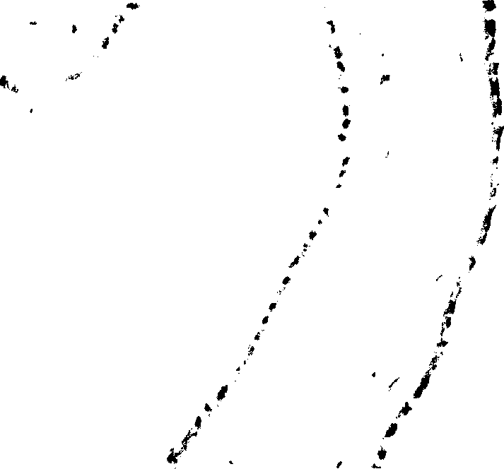 Glue adhesion amnion and preparation method thereof