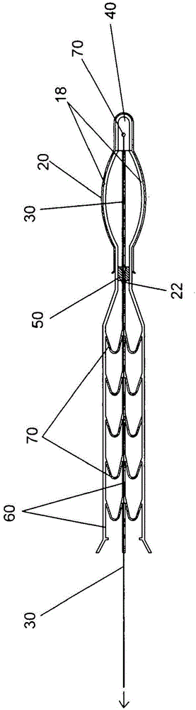 Lumen occluding device, delivery catheter and method