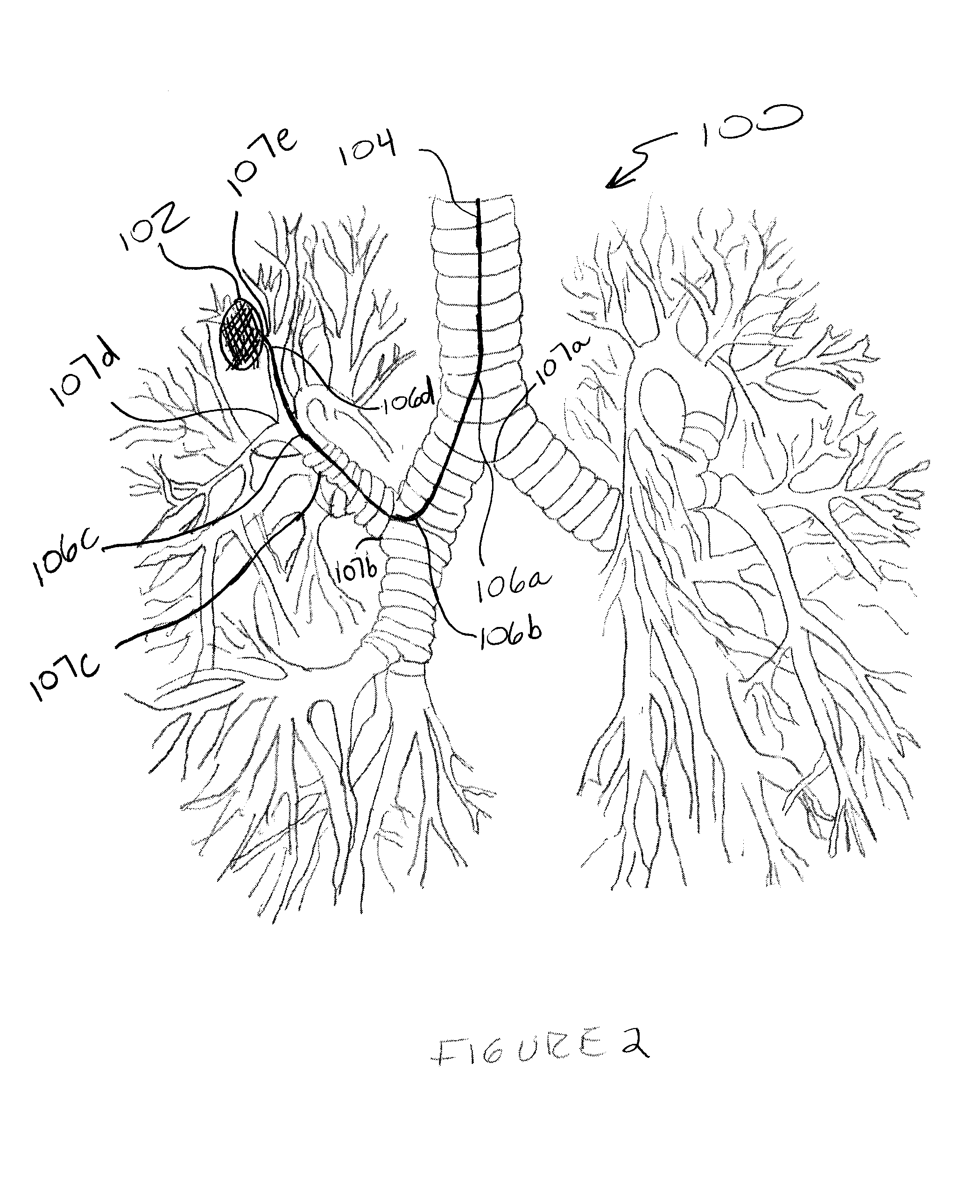 Controlled Perspective Guidance Method