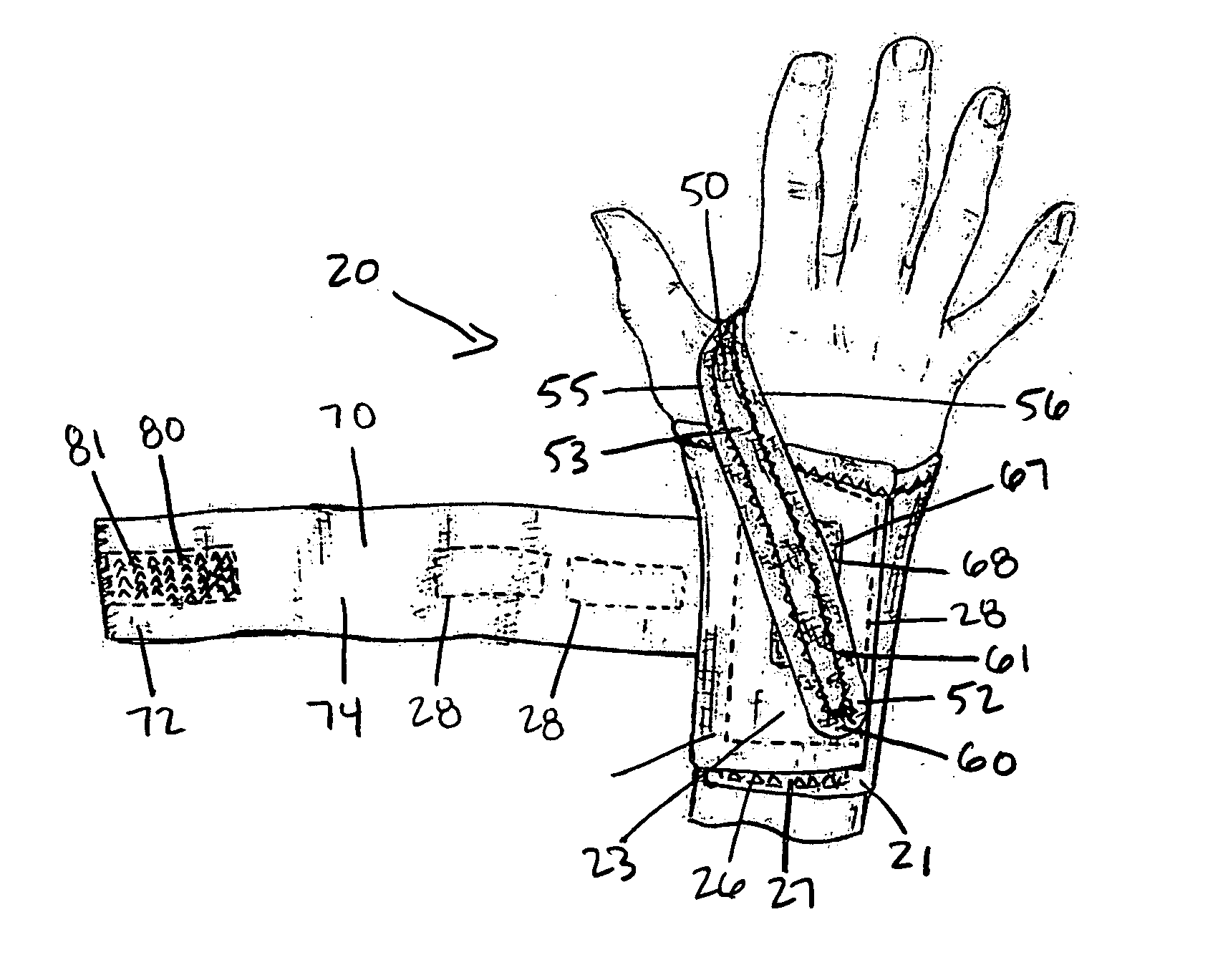 Wrist brace with adjustable support