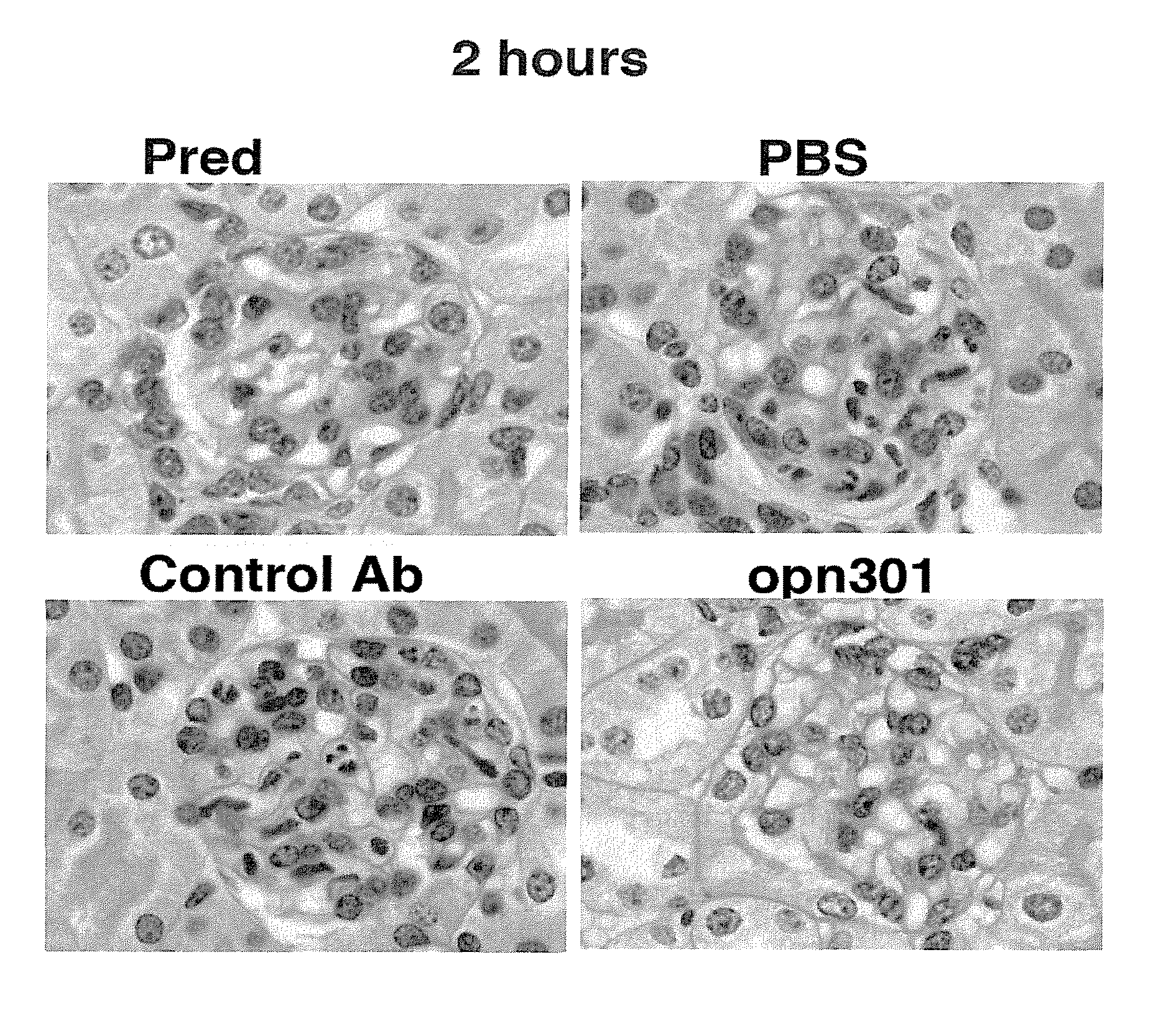 Compounds and methods for the treatment of renal disease