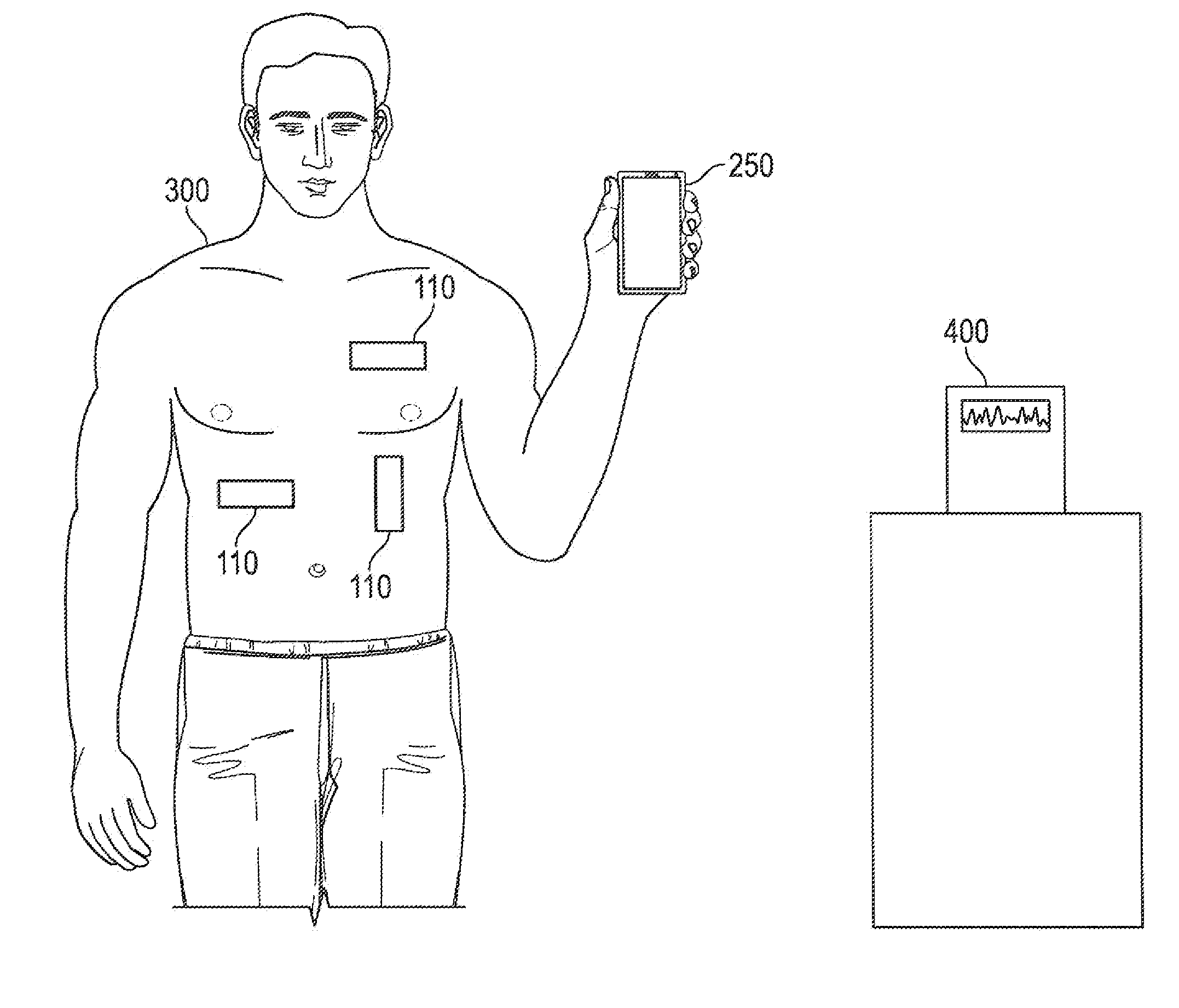 Wireless ECG sensor system and method