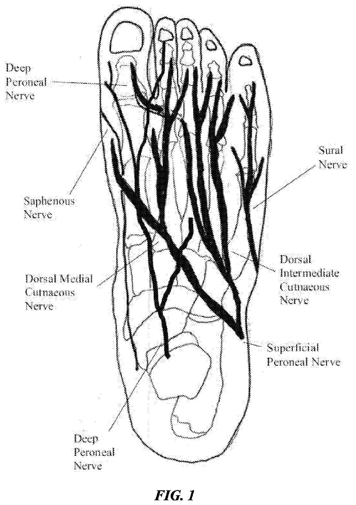 Peripheral Neuromodulation to Treat Bladder and Bowel Dysfunction