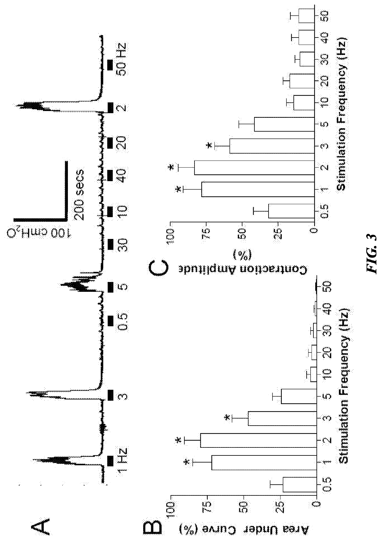 Peripheral Neuromodulation to Treat Bladder and Bowel Dysfunction