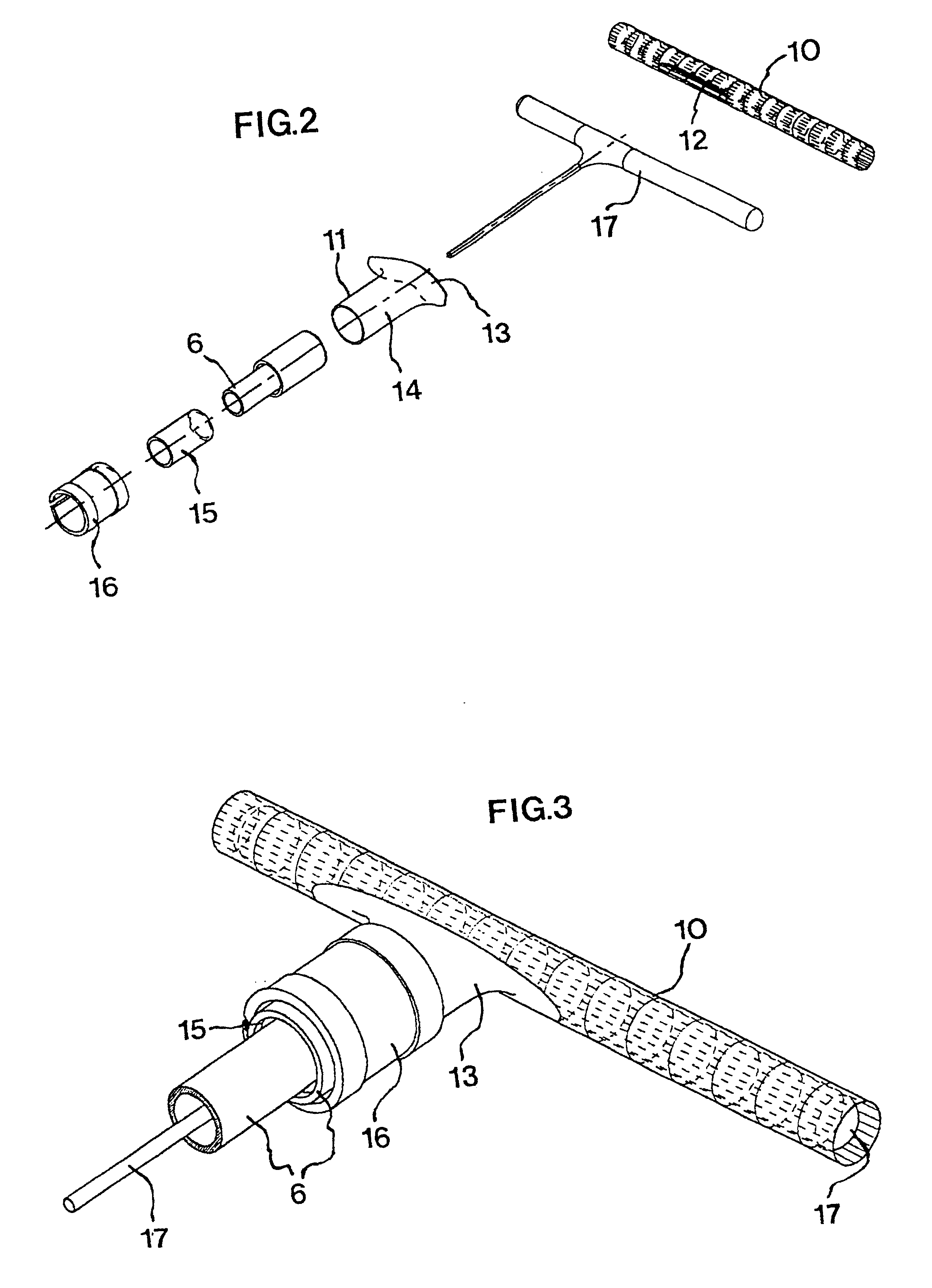 By-pass graft