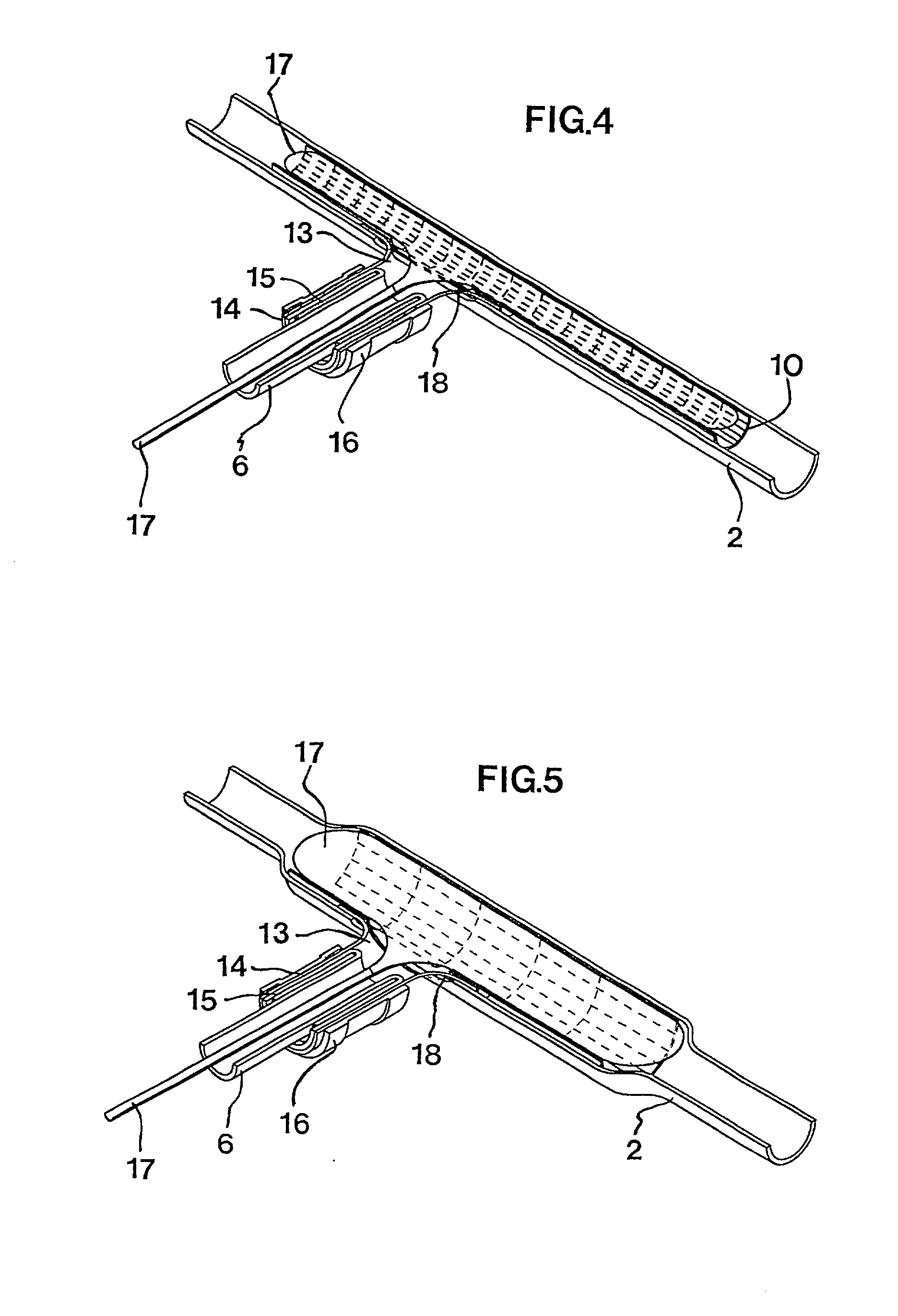 By-pass graft