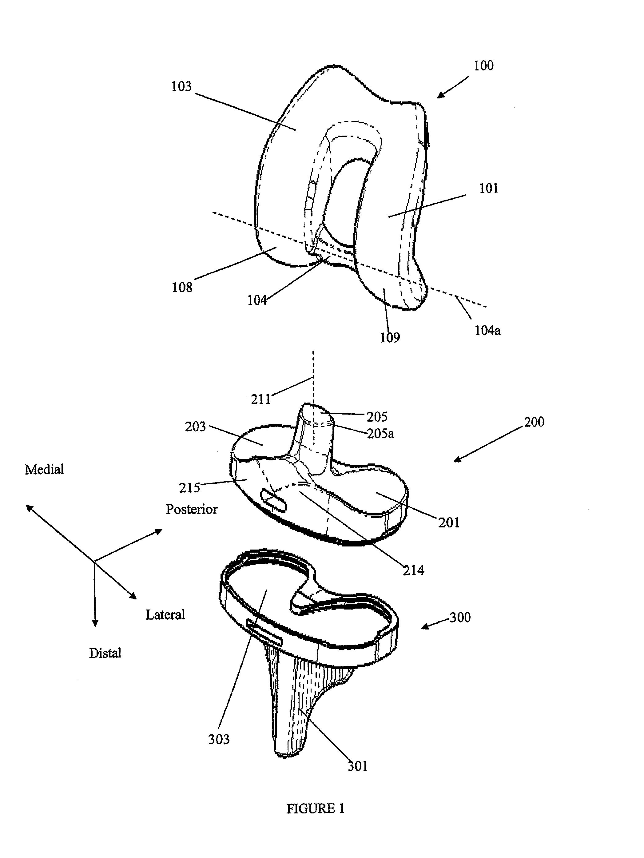 Prosthetic joint