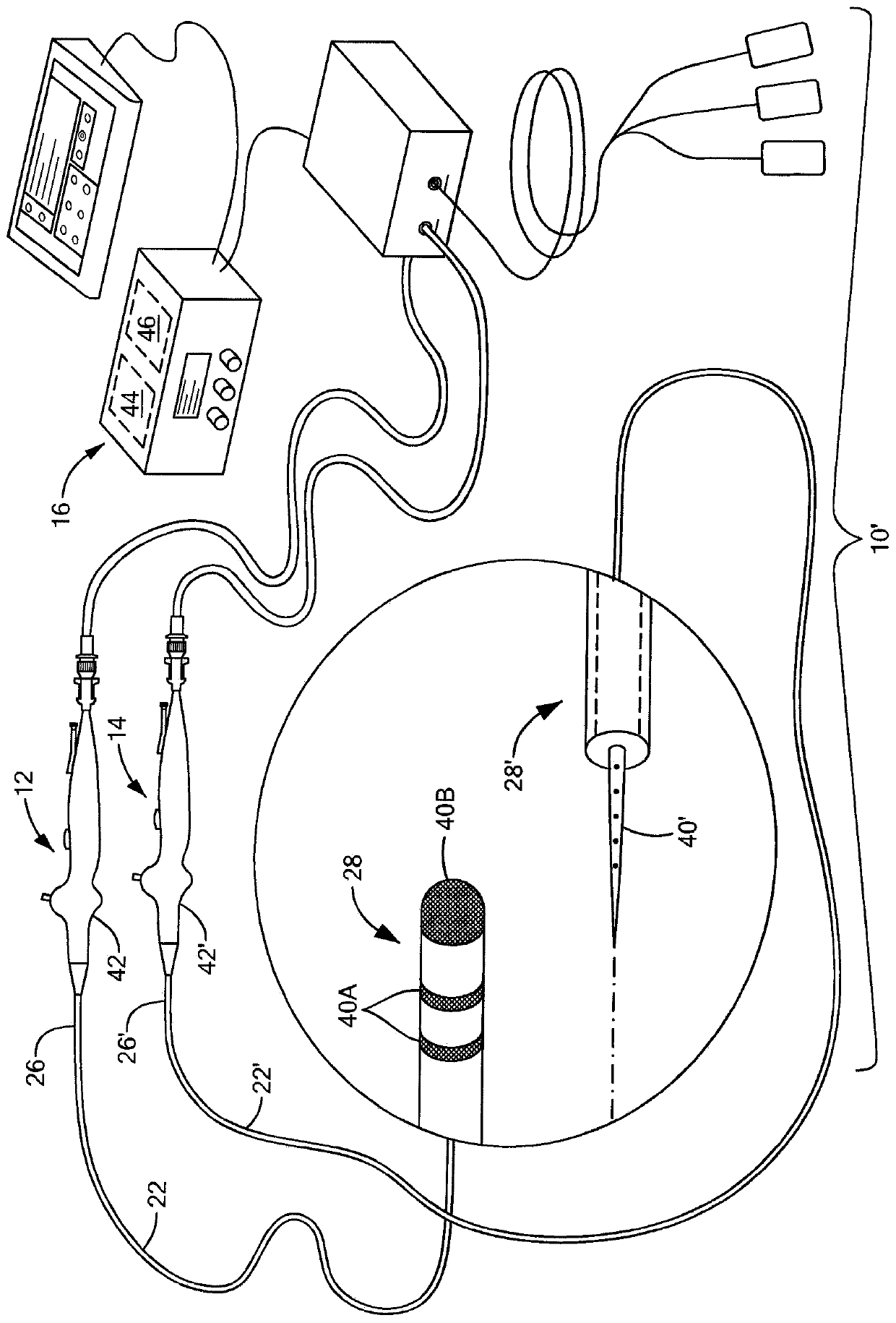 Enhanced electroporation of cardiac tissue