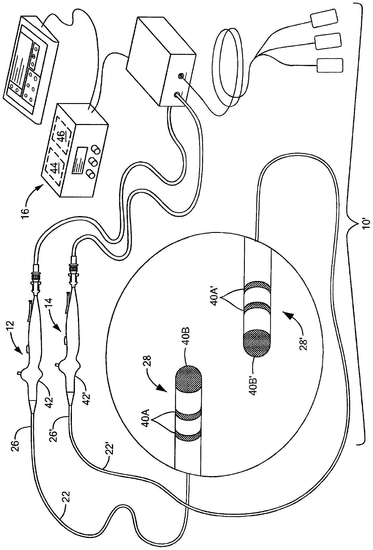 Enhanced electroporation of cardiac tissue