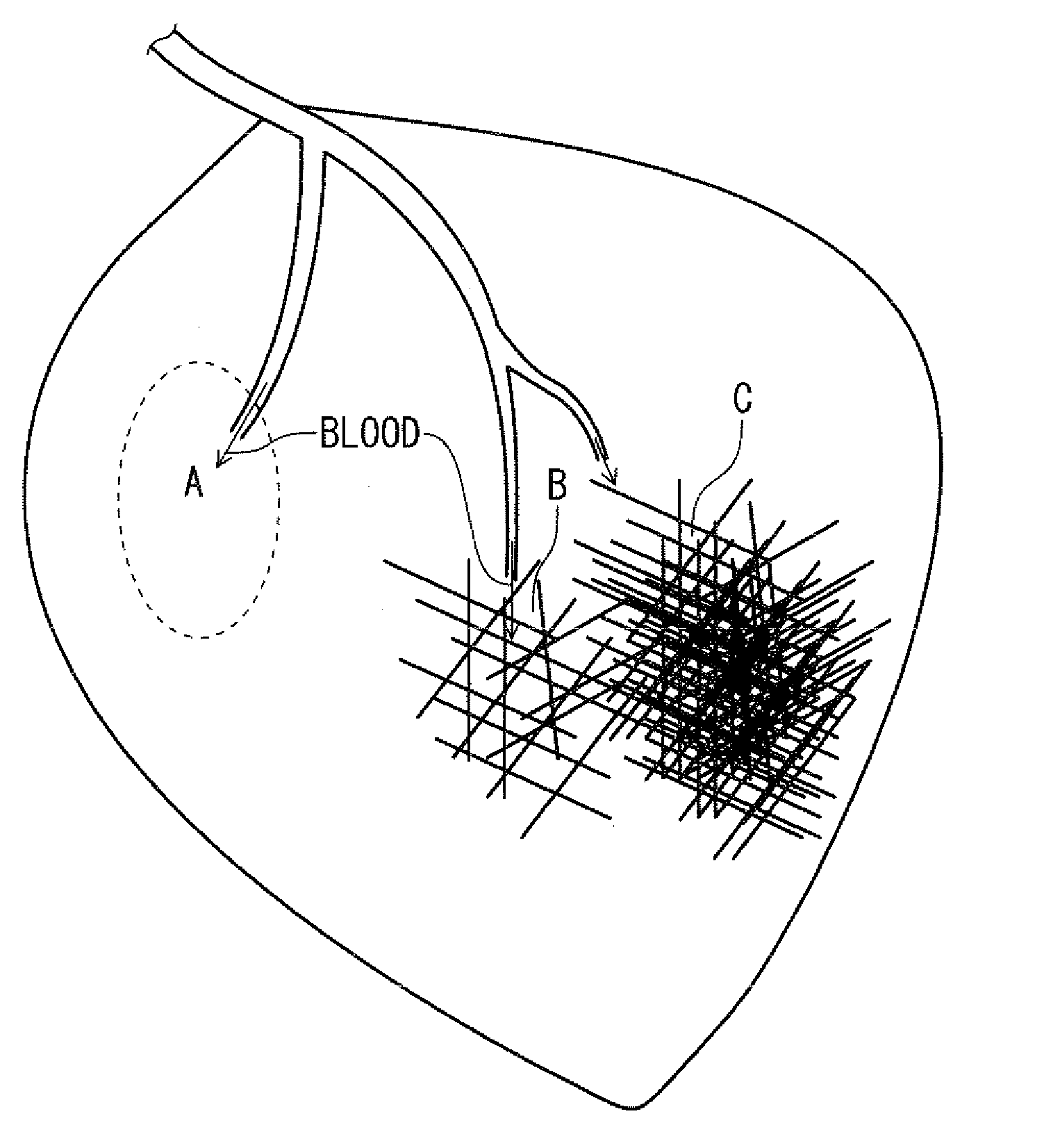 Magnetic resonance imaging apparatus and magnetic resonance imaging method