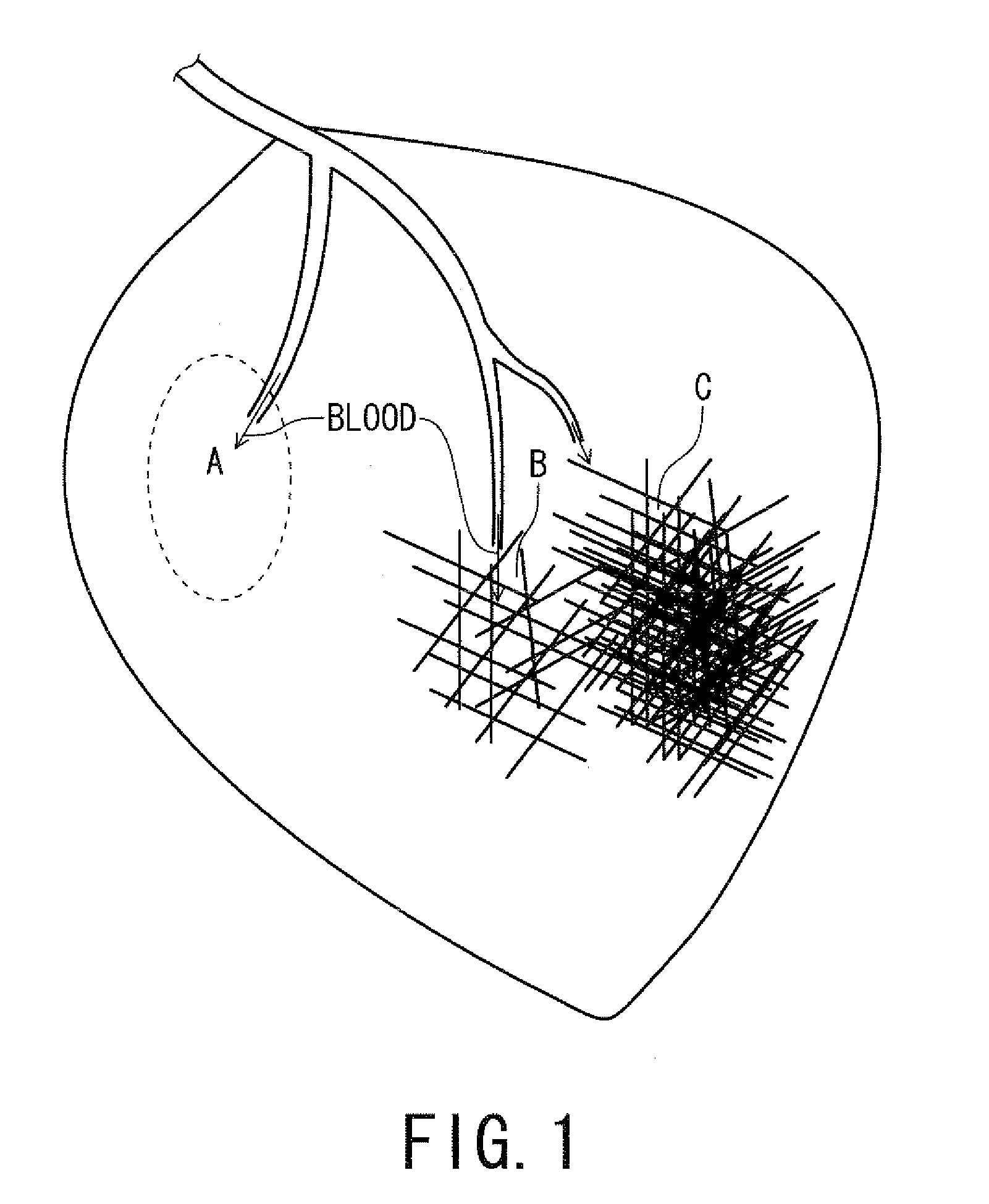 Magnetic resonance imaging apparatus and magnetic resonance imaging method