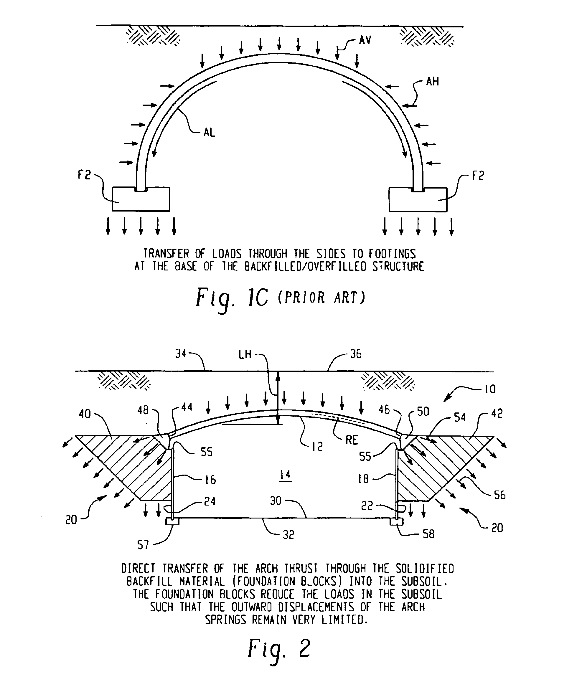 Top arch overfilled system