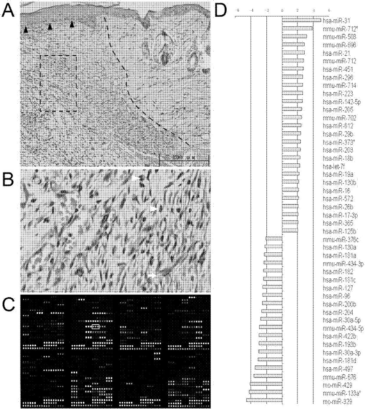 Application of miR-21 to preparing medicines for promoting healing of skin injury