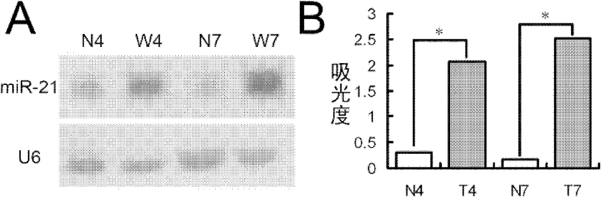 Application of miR-21 to preparing medicines for promoting healing of skin injury