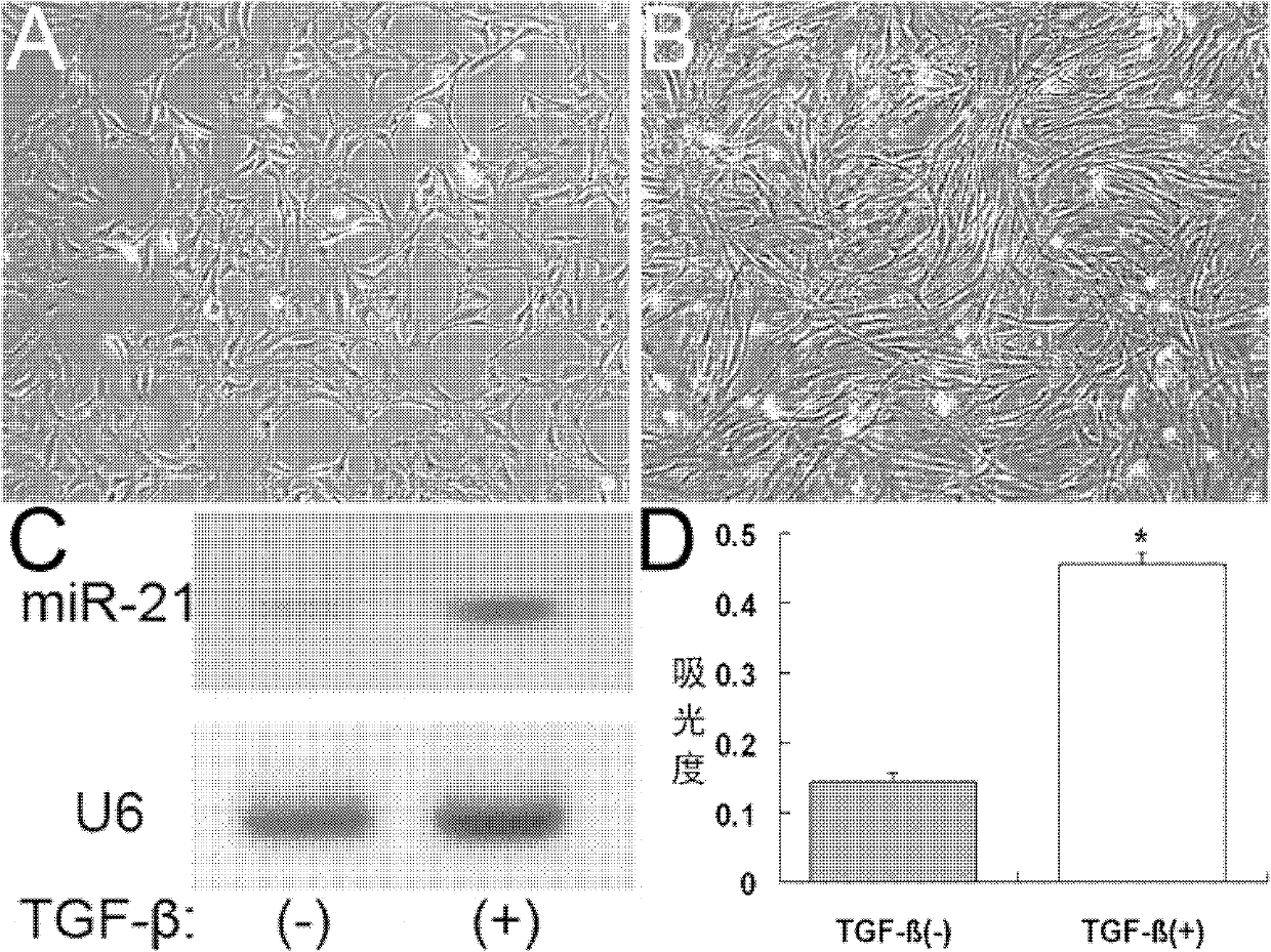 Application of miR-21 to preparing medicines for promoting healing of skin injury