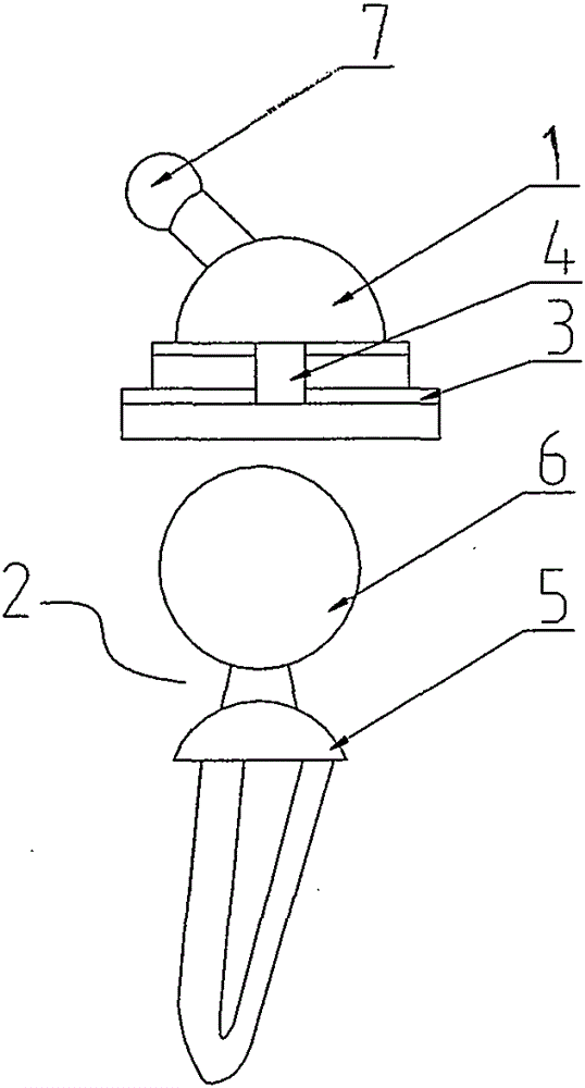 All-ceramic artificial hip-joint prosthesis and preparation method thereof