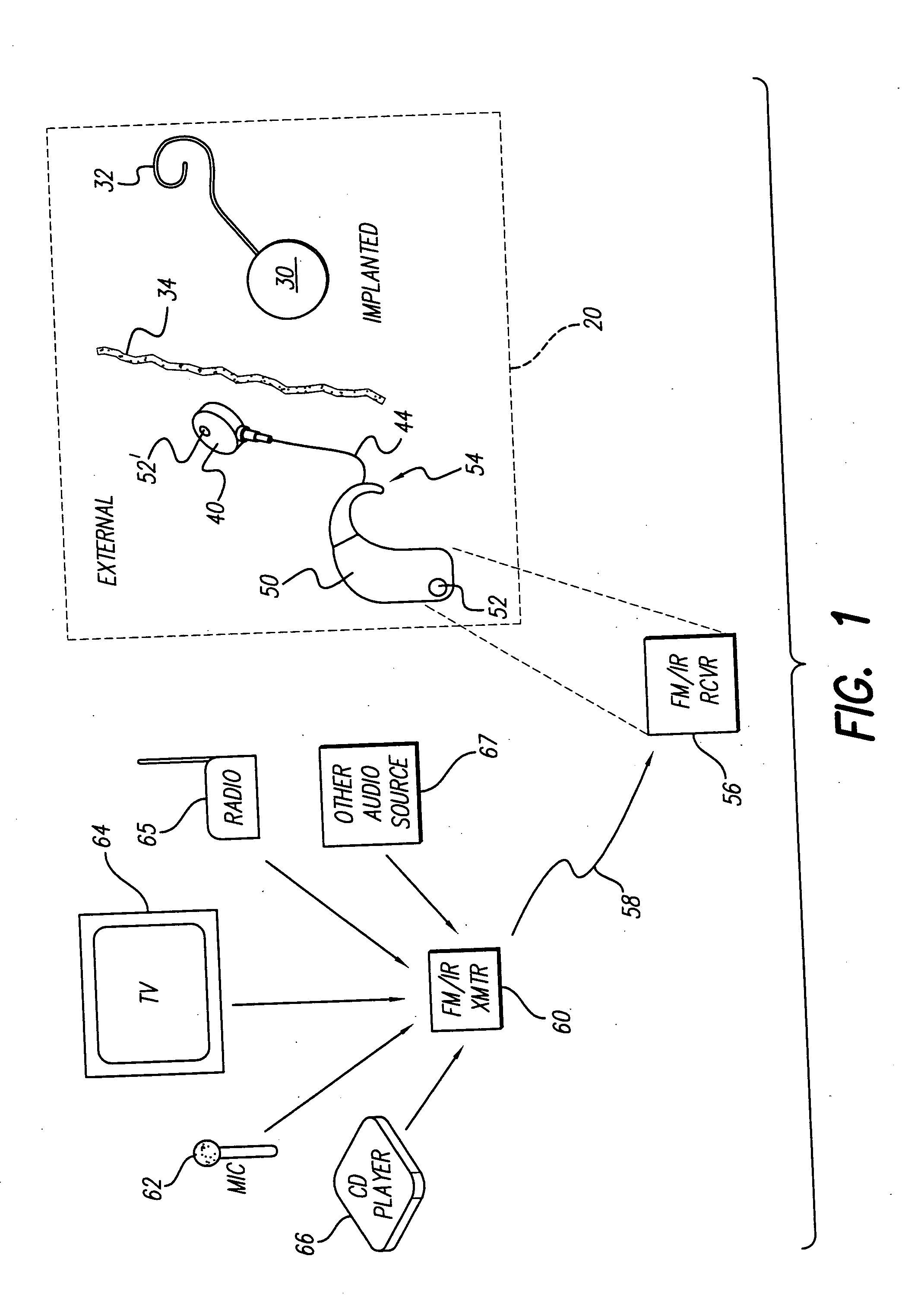 Assistive listening technology integrated into a Behind-The-Ear sound processor