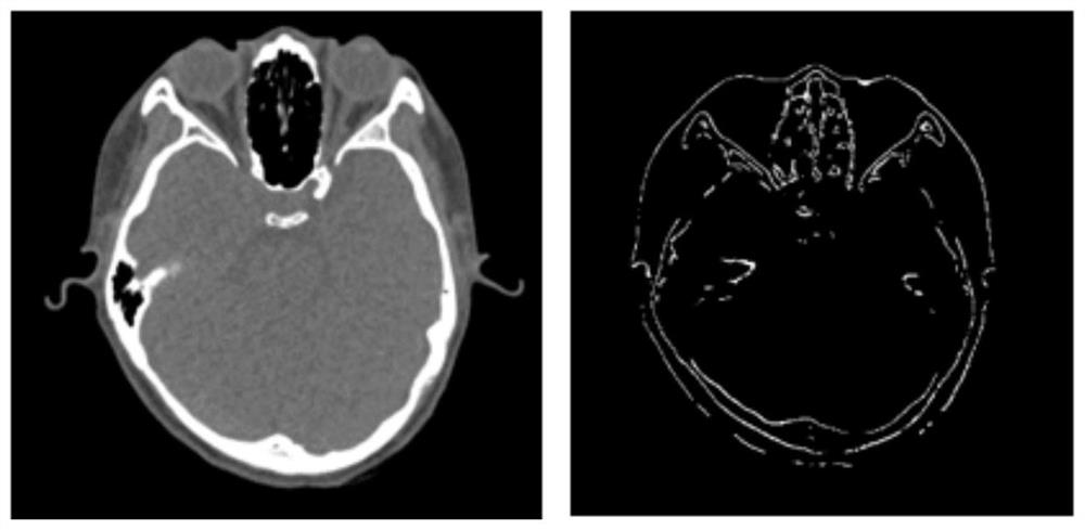 A method for registration and fusion display of multi-modal 3D images