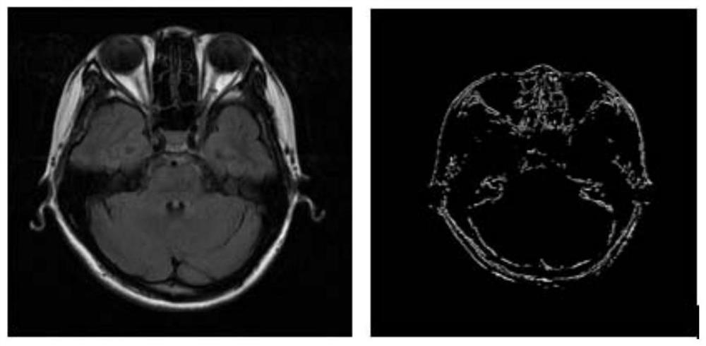 A method for registration and fusion display of multi-modal 3D images