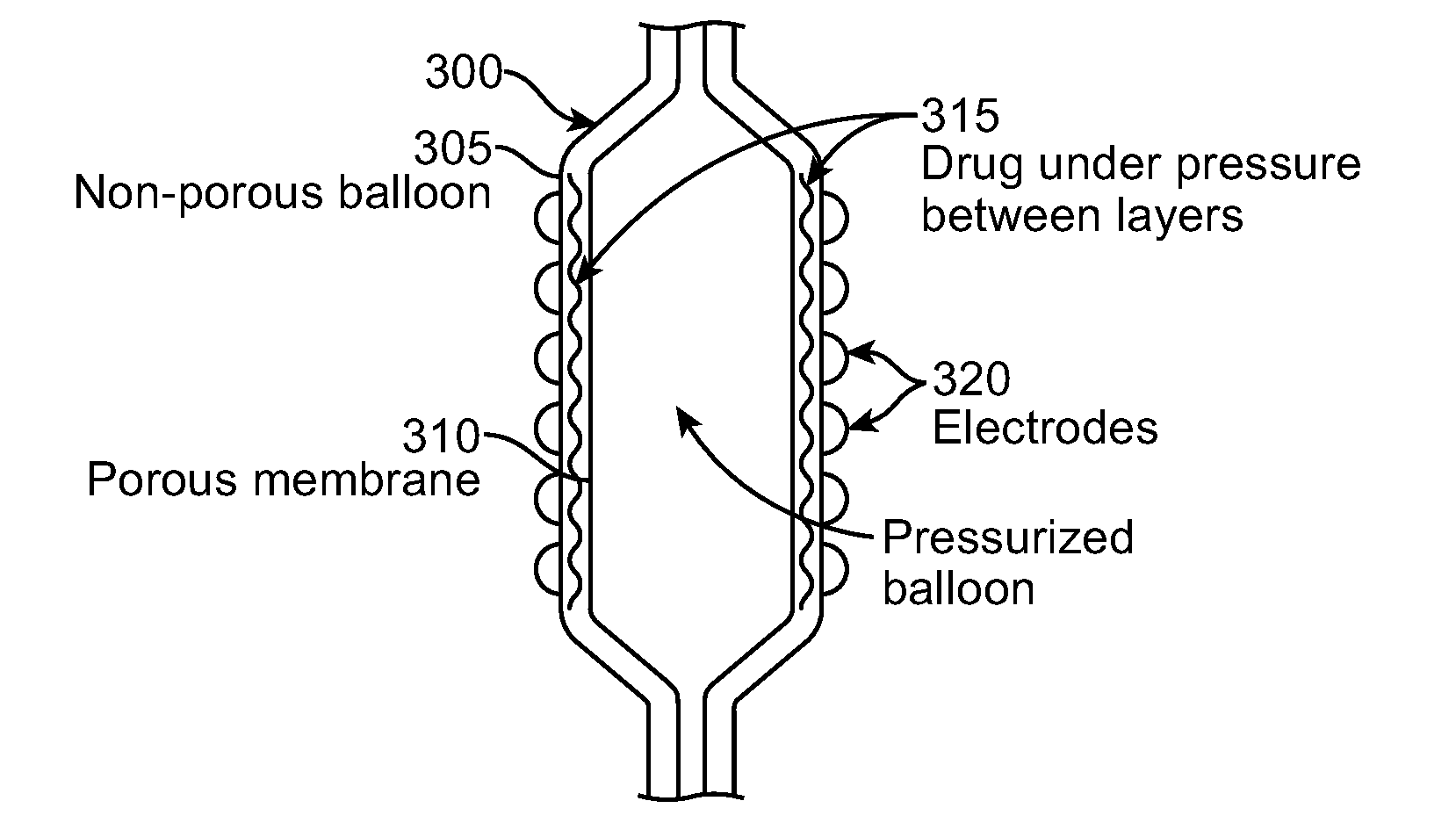 Selective Drug Delivery In a Lumen