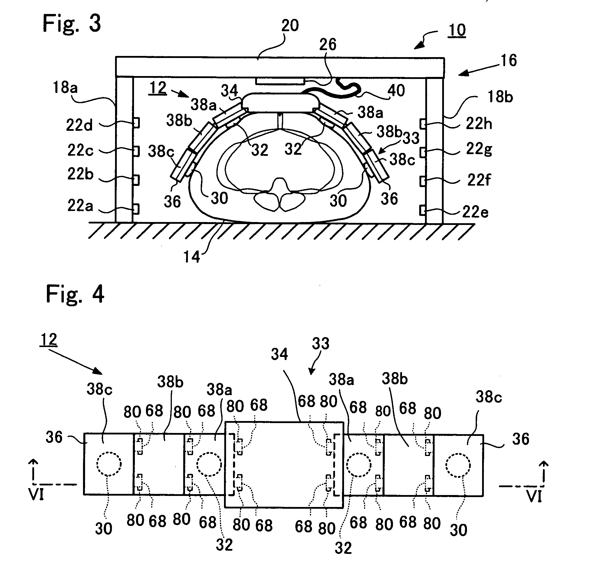 Abdominal impedance measurement apparatus