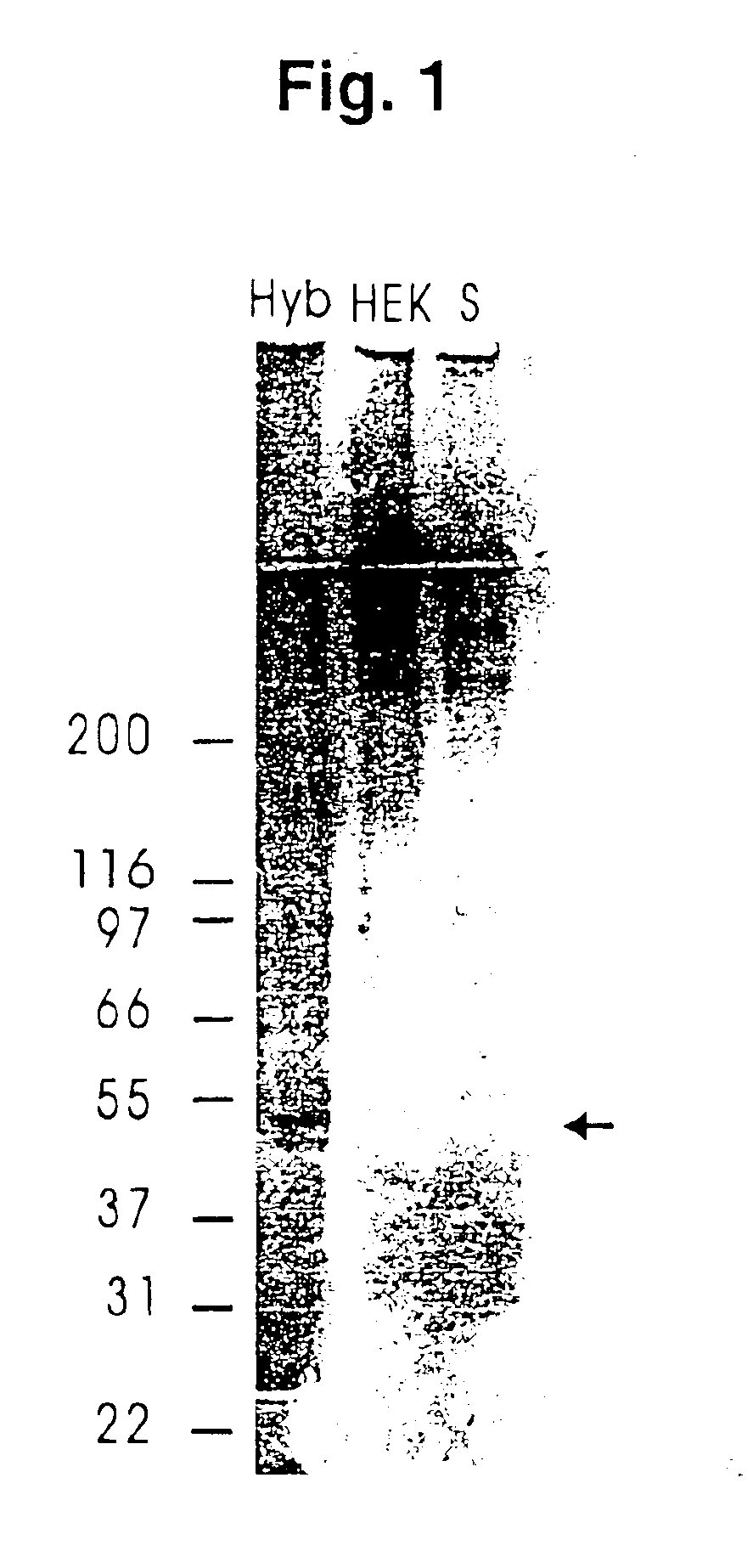 Recombinant human mannan-binding lectin