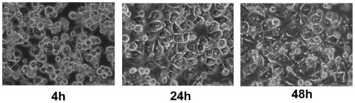 Method for separating liver cells and hepatic stellate cells in animals infected with echinococcus multilocularis