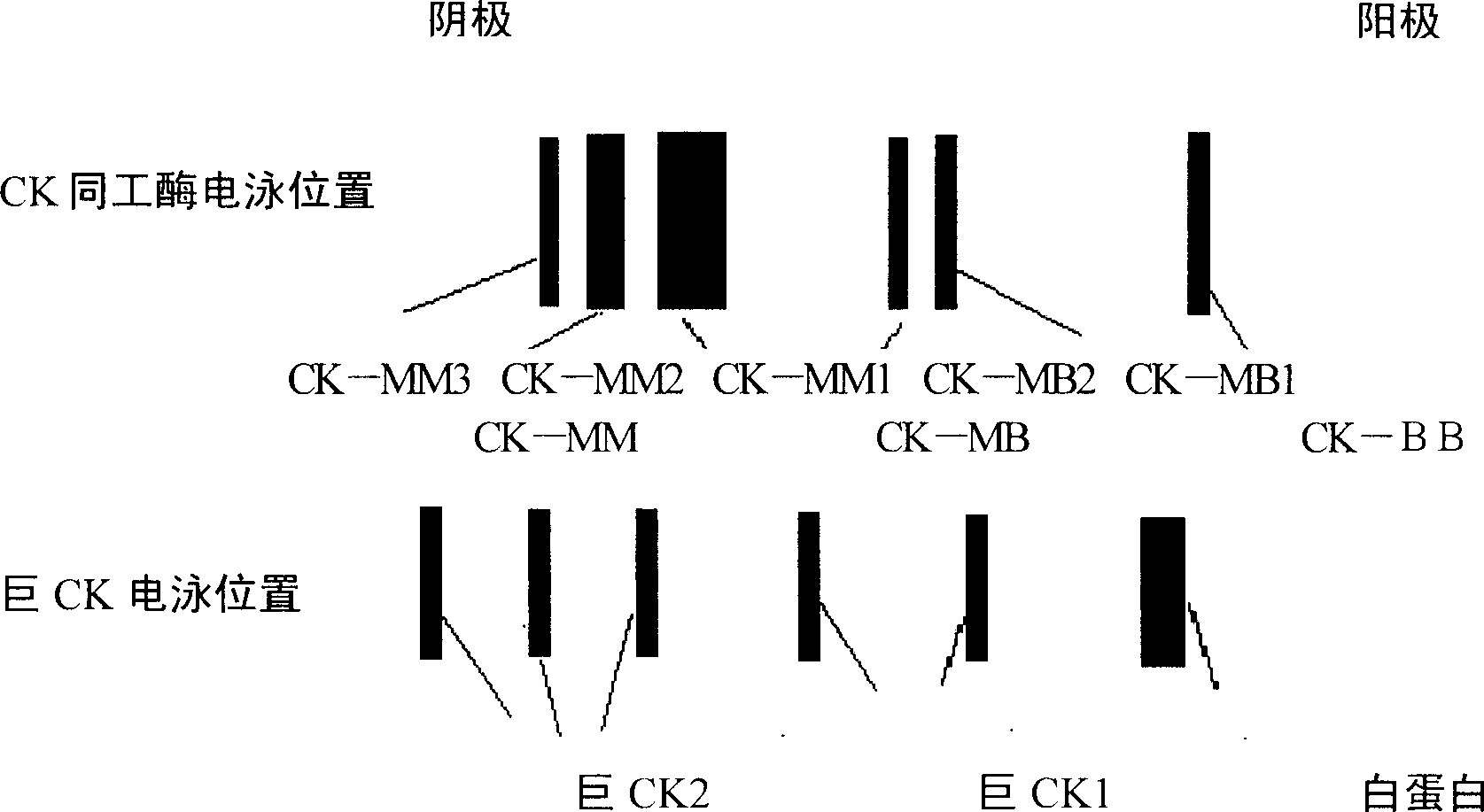 Macro creatine kinase agarose electrophoresis kit and preparation method thereof