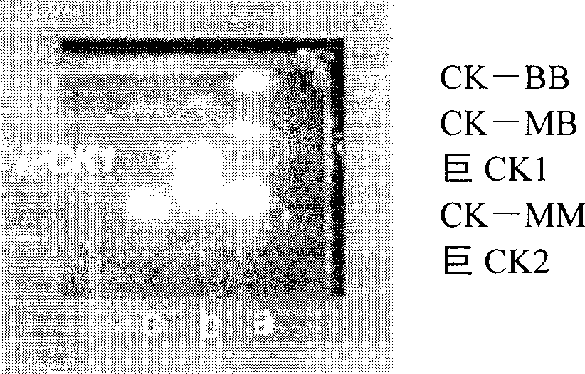 Macro creatine kinase agarose electrophoresis kit and preparation method thereof