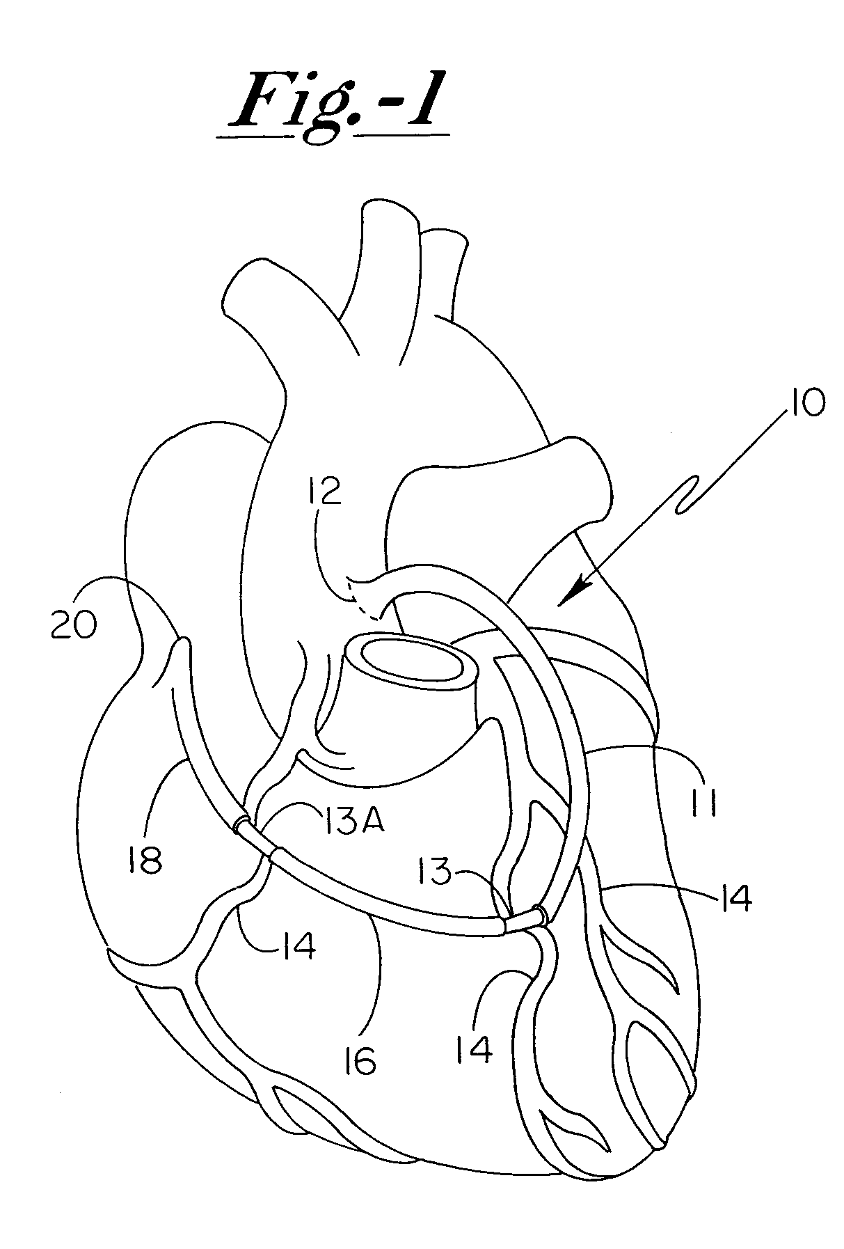 Grafted network incorporating a multiple channel fluid flow connector