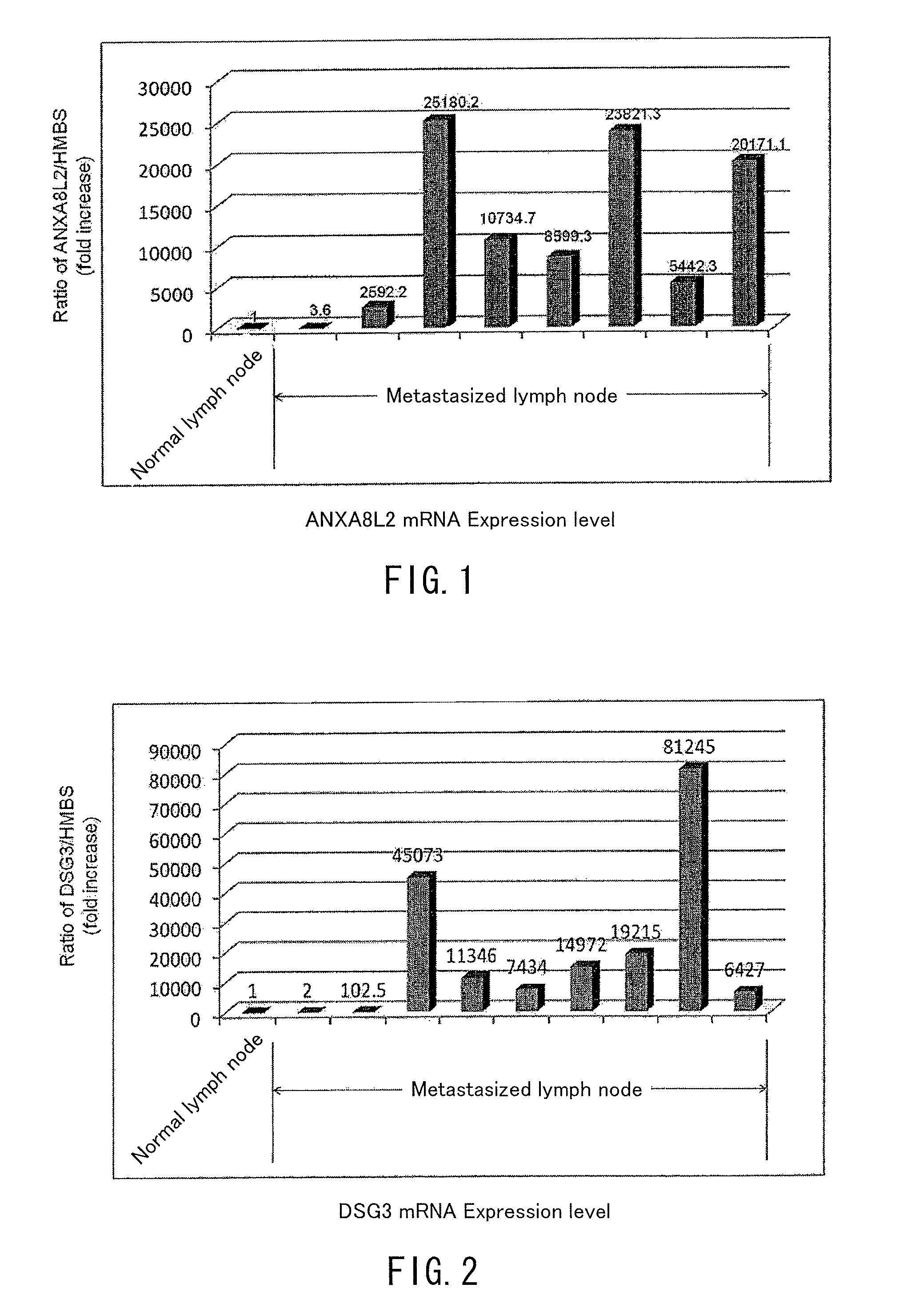 Method for analyzing cervical lymph node metastasis, and tumor marker for head and neck cancer