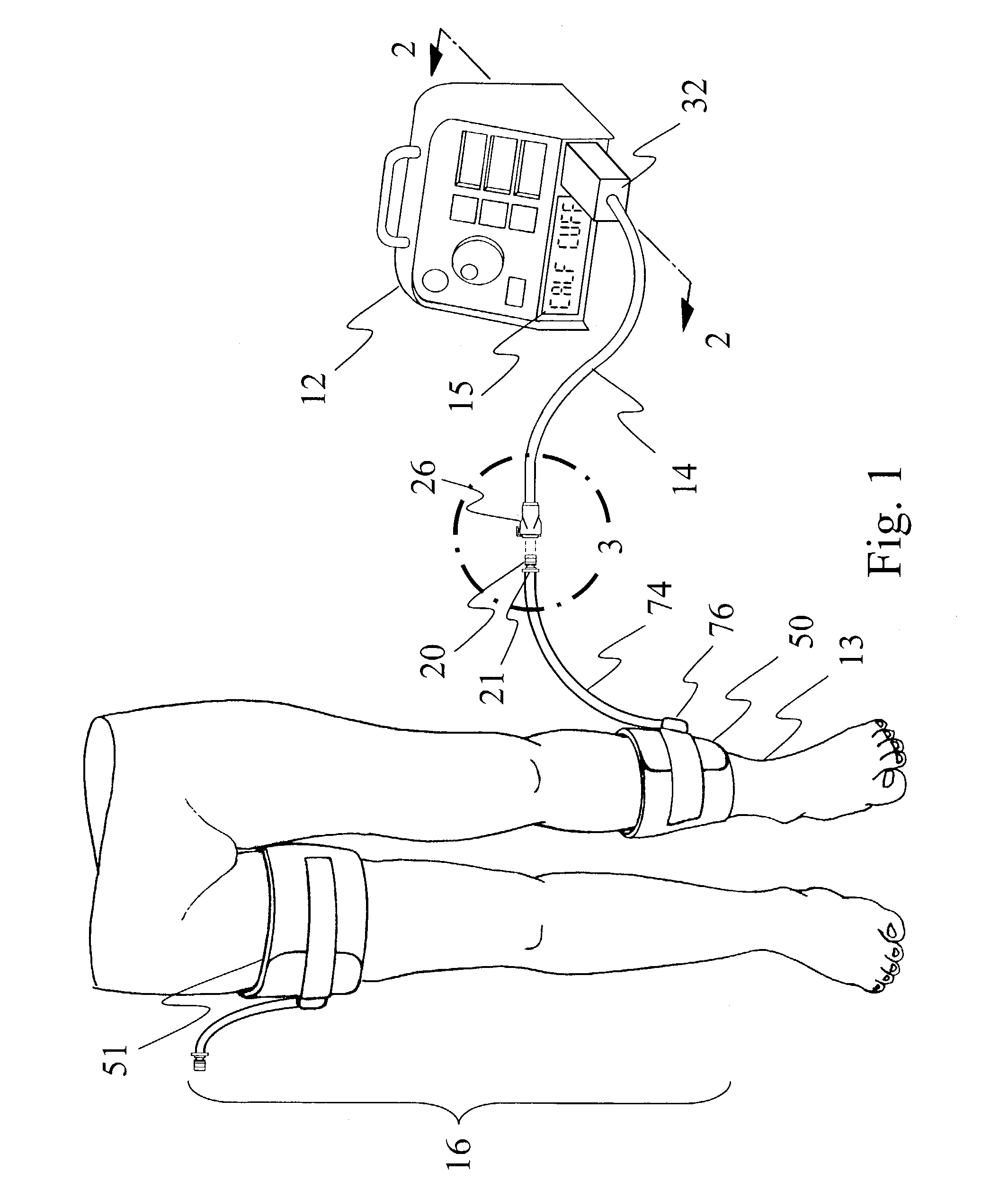 Adaptive tourniquet cuff system